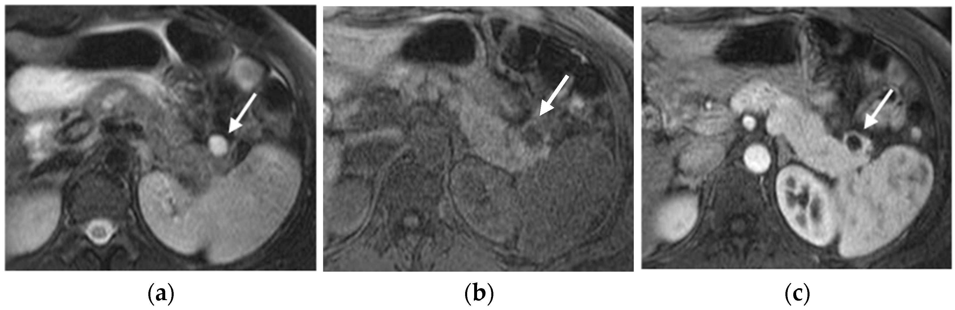 Diagnostics 15 01164 g005a Diagnostics 15 01164 g005a
