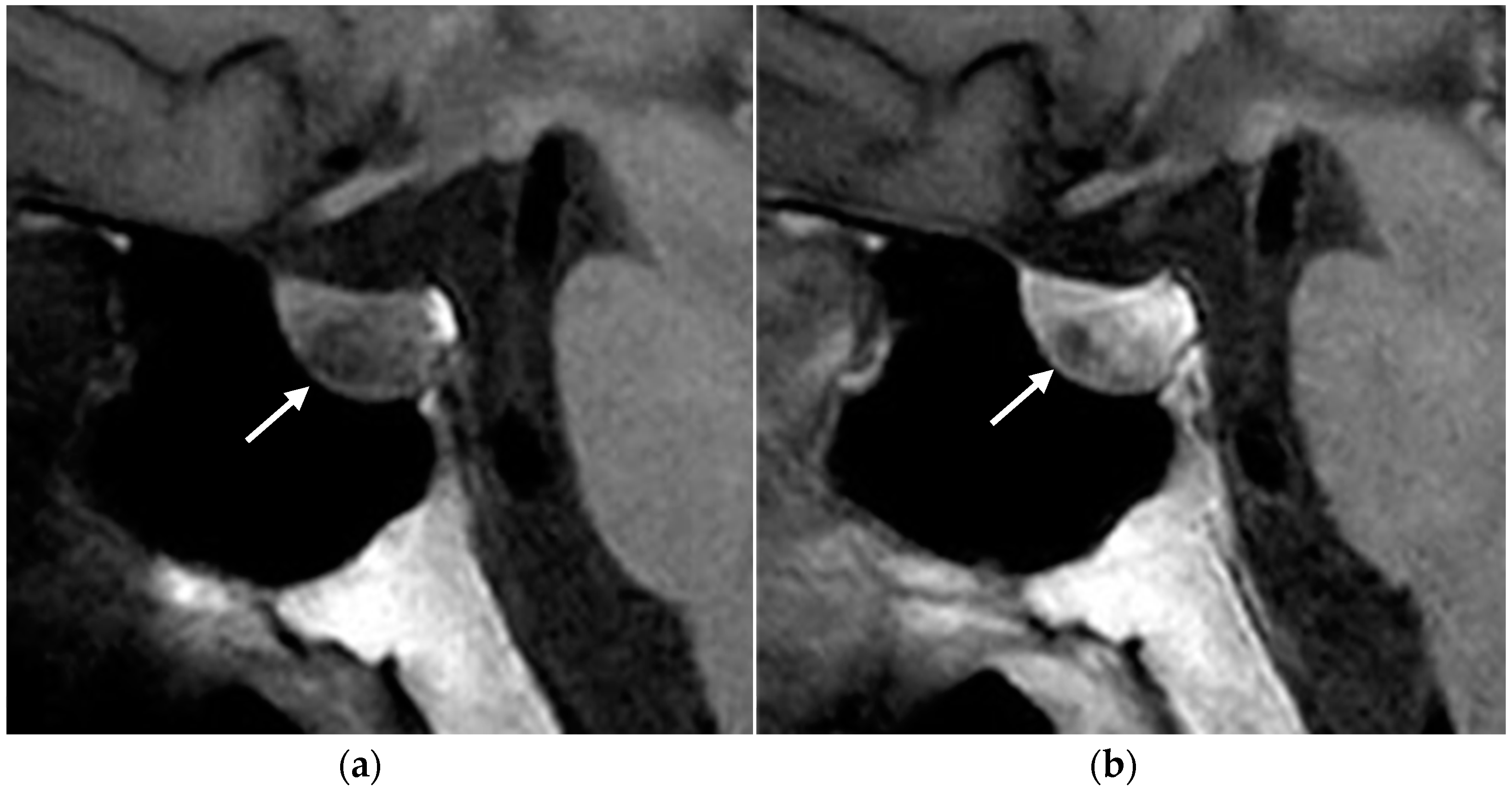 Diagnostics 15 01164 g008 Diagnostics 15 01164 g008