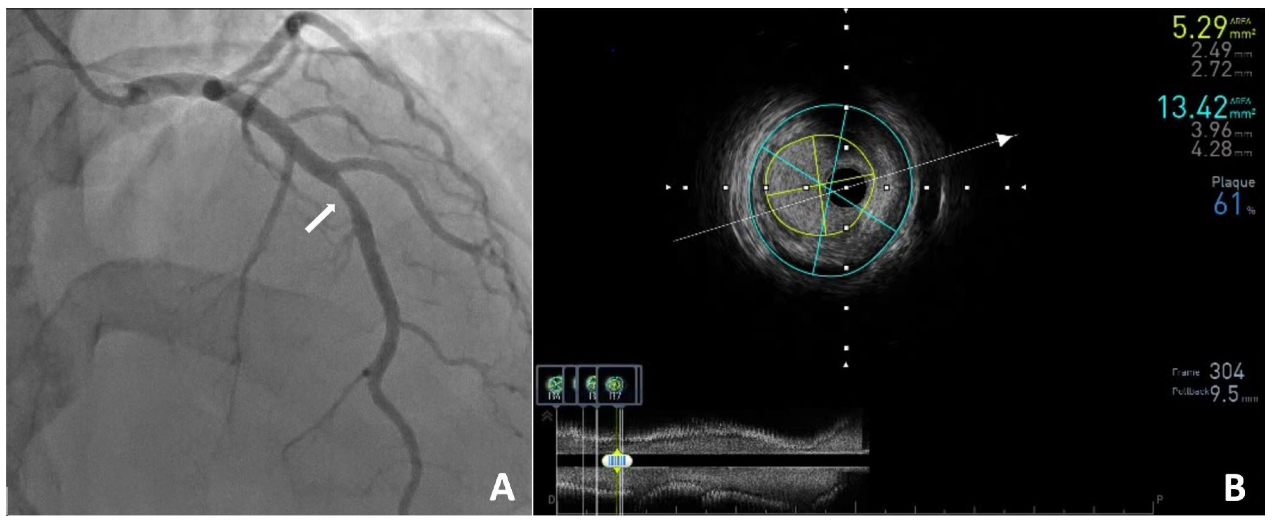Diagnostics 15 01169 g002