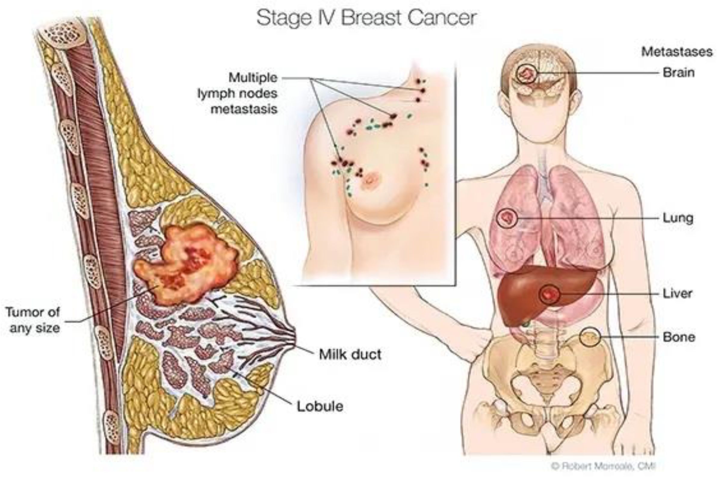 Diagnostics 15 01173 g001