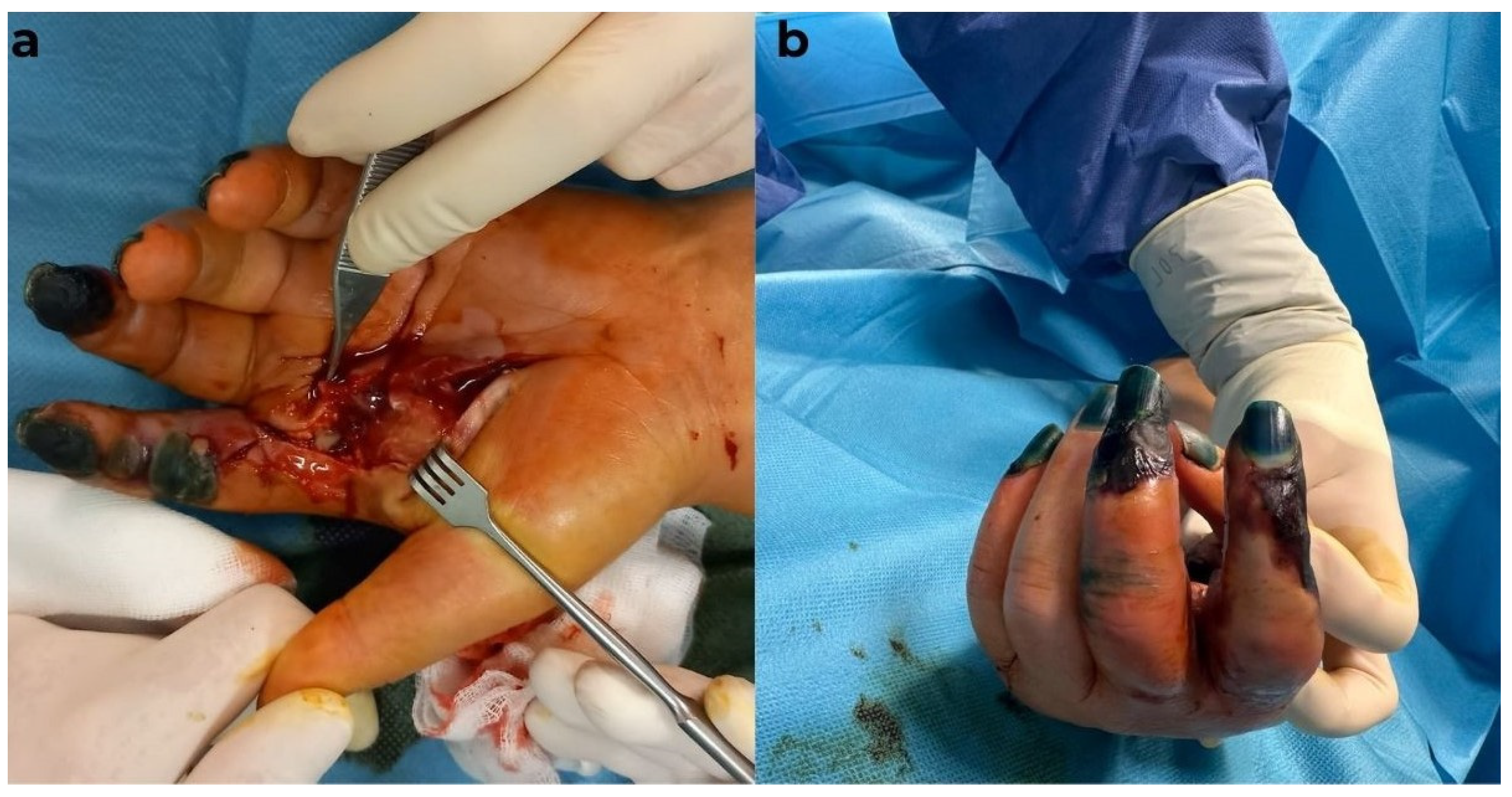 Diagnostics 15 01179 g005