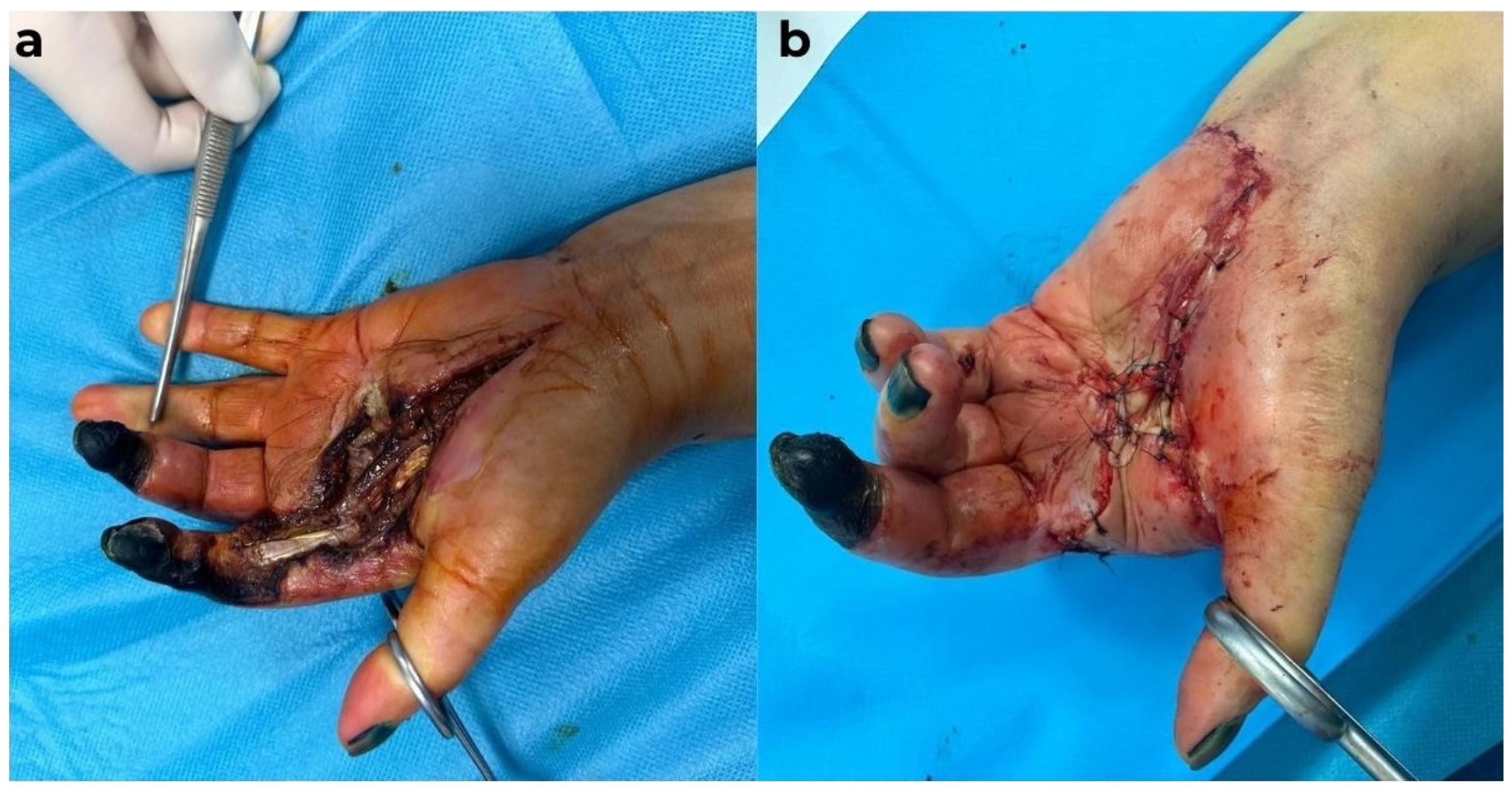 Diagnostics 15 01179 g006