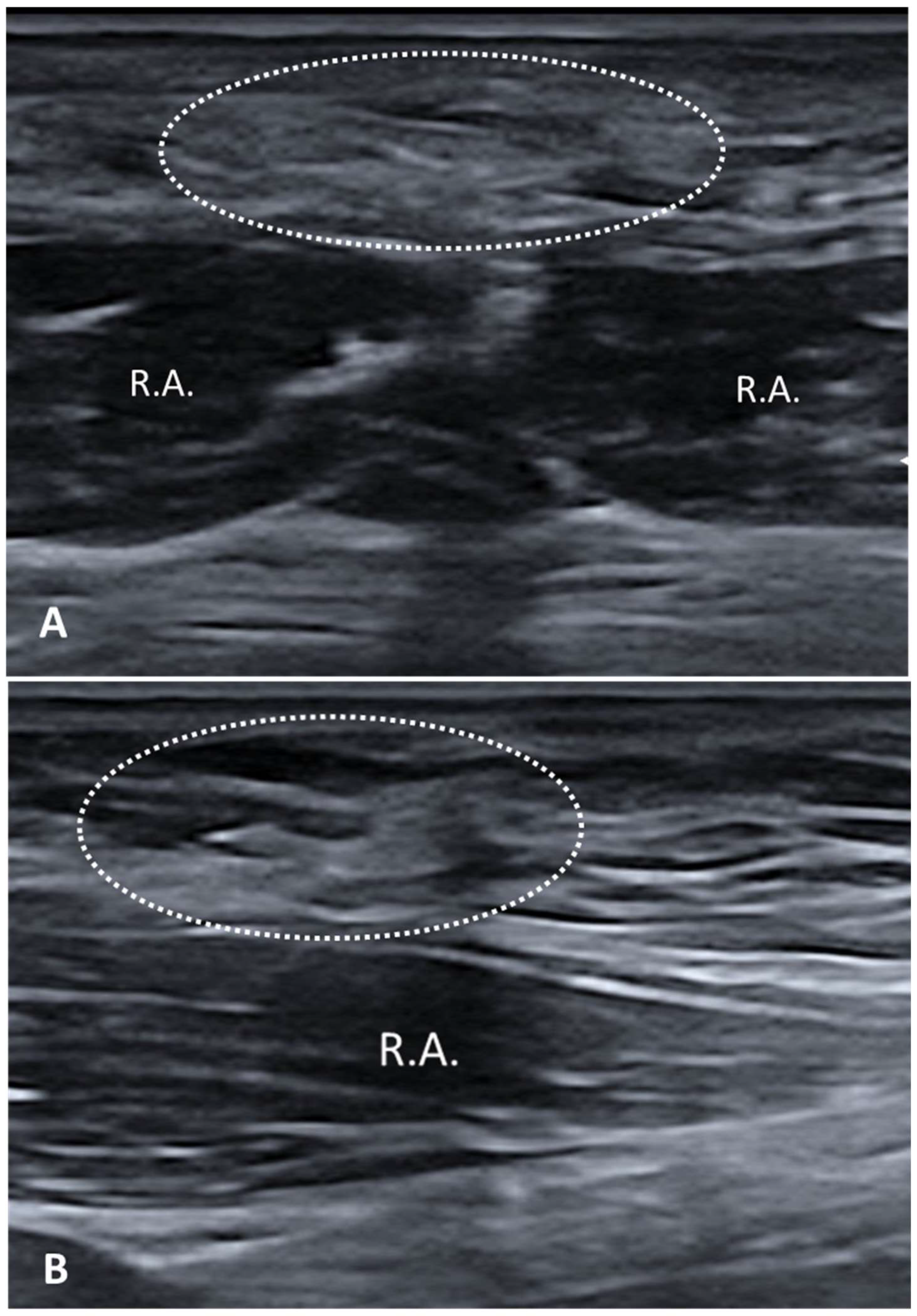 Diagnostics 15 01180 g004