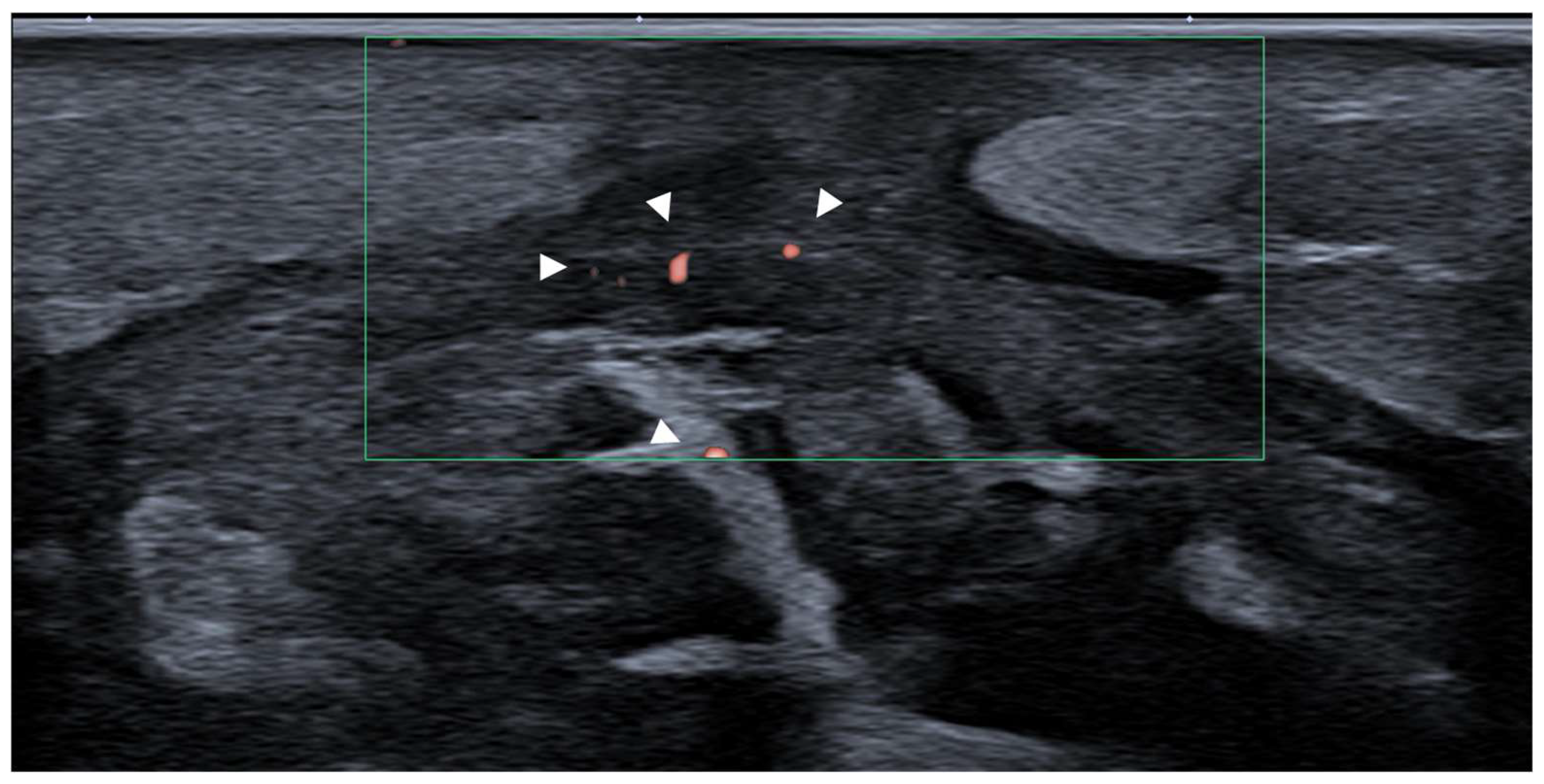 Diagnostics 15 01180 g011