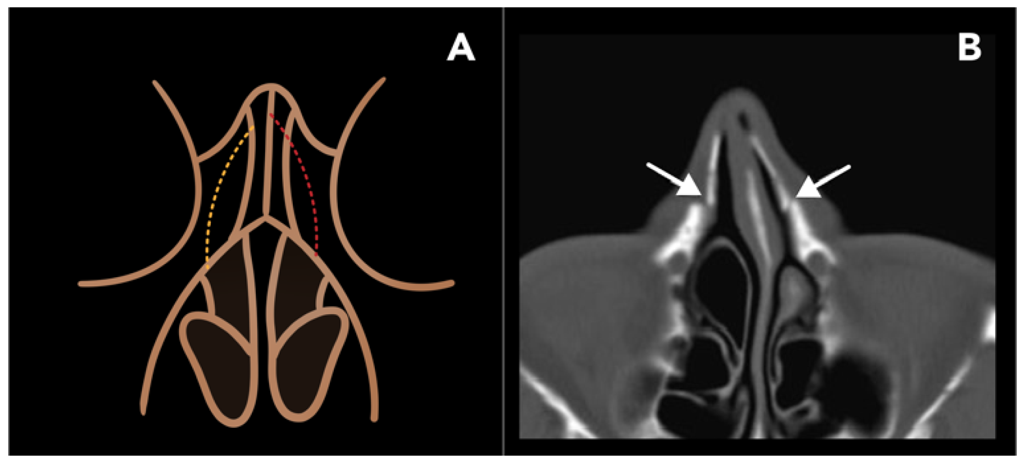 Diagnostics 15 01184 g004