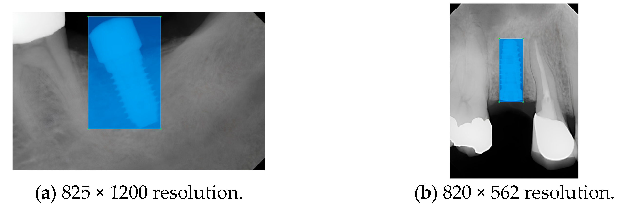 Diagnostics 15 01194 g004