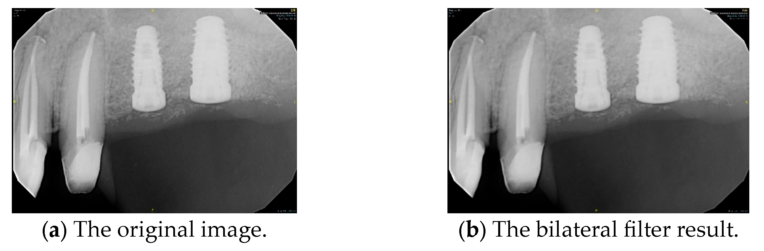 Diagnostics 15 01194 g006