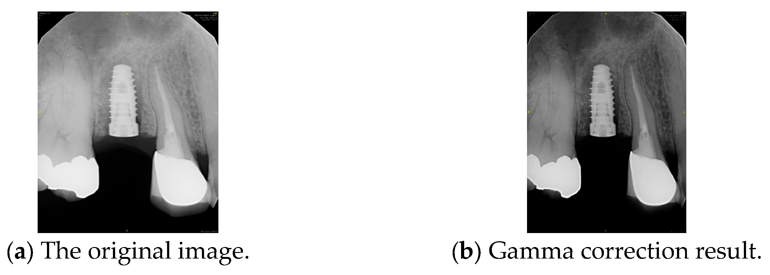 Diagnostics 15 01194 g007