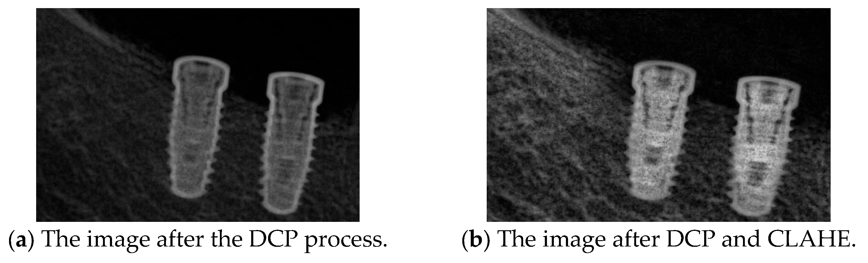 Diagnostics 15 01194 g012