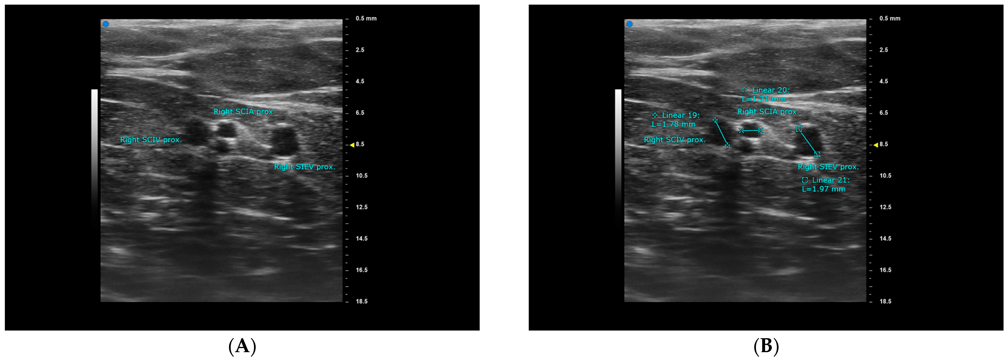 Diagnostics 15 01210 g002