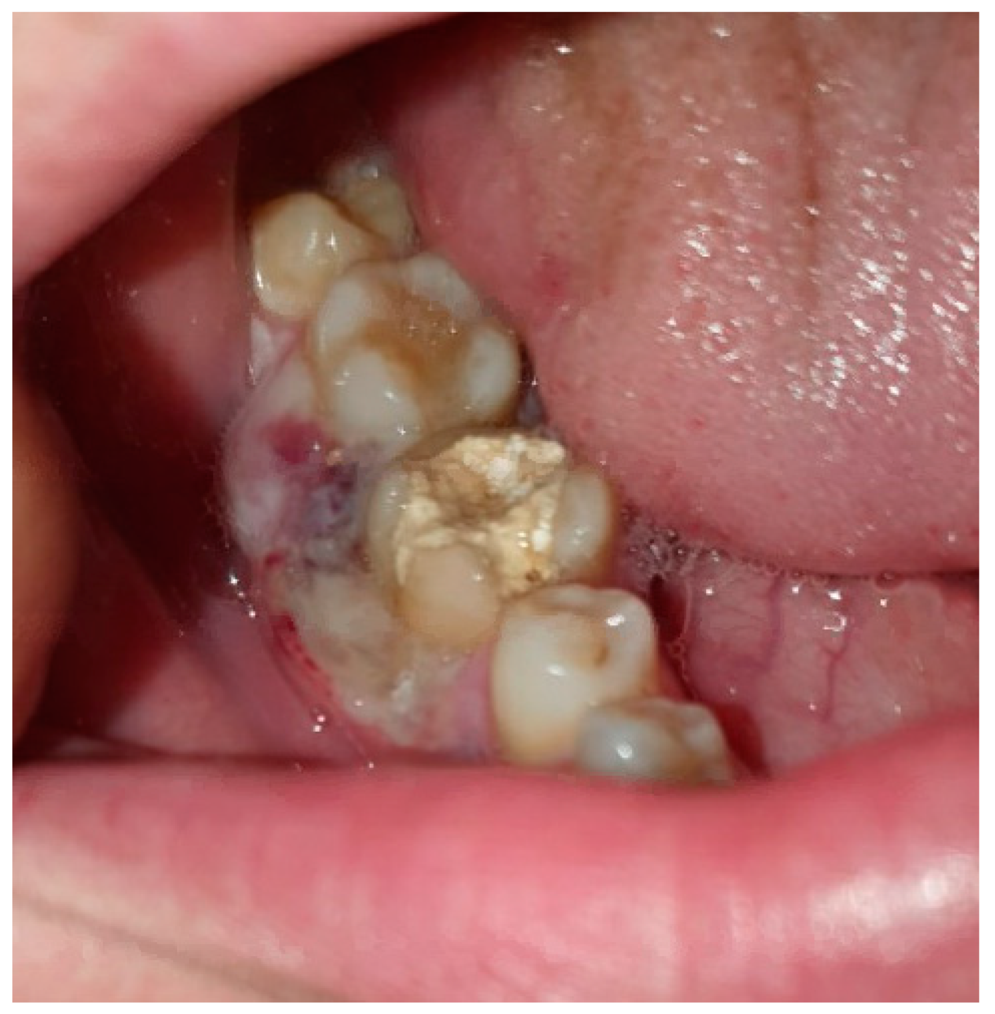 Diagnostics 15 01215 g002