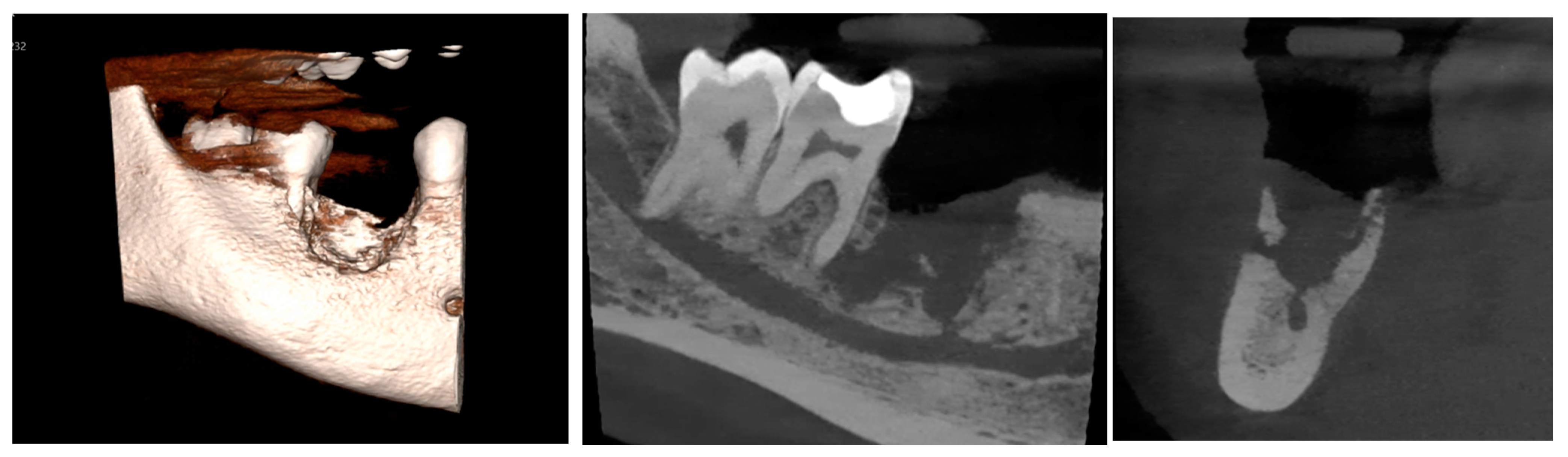 Diagnostics 15 01215 g004