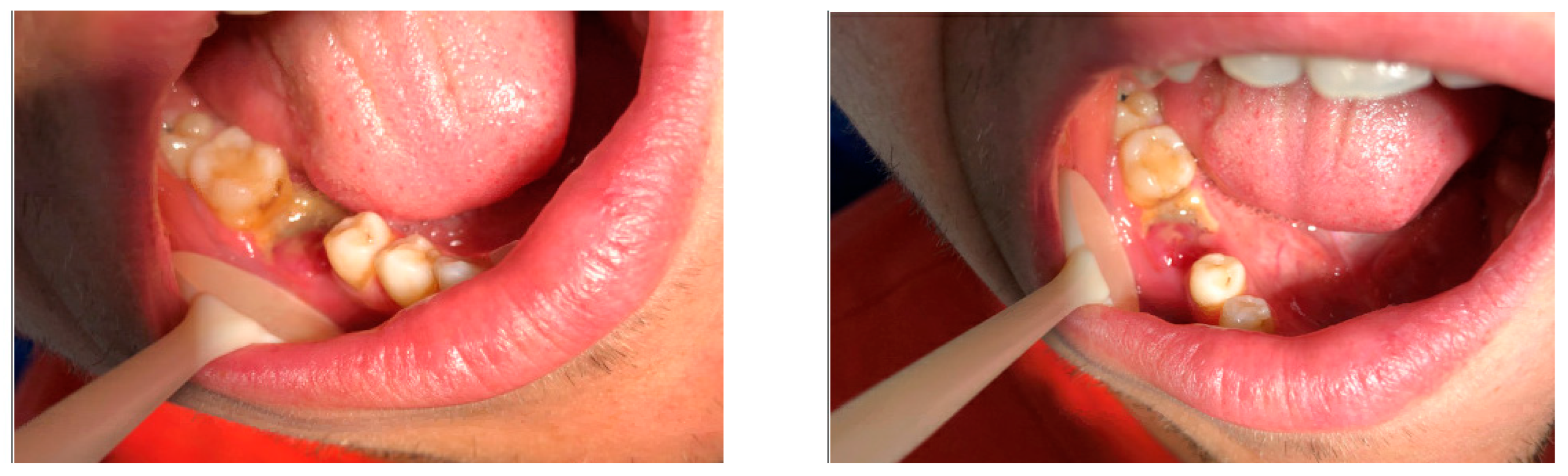 Diagnostics 15 01215 g005