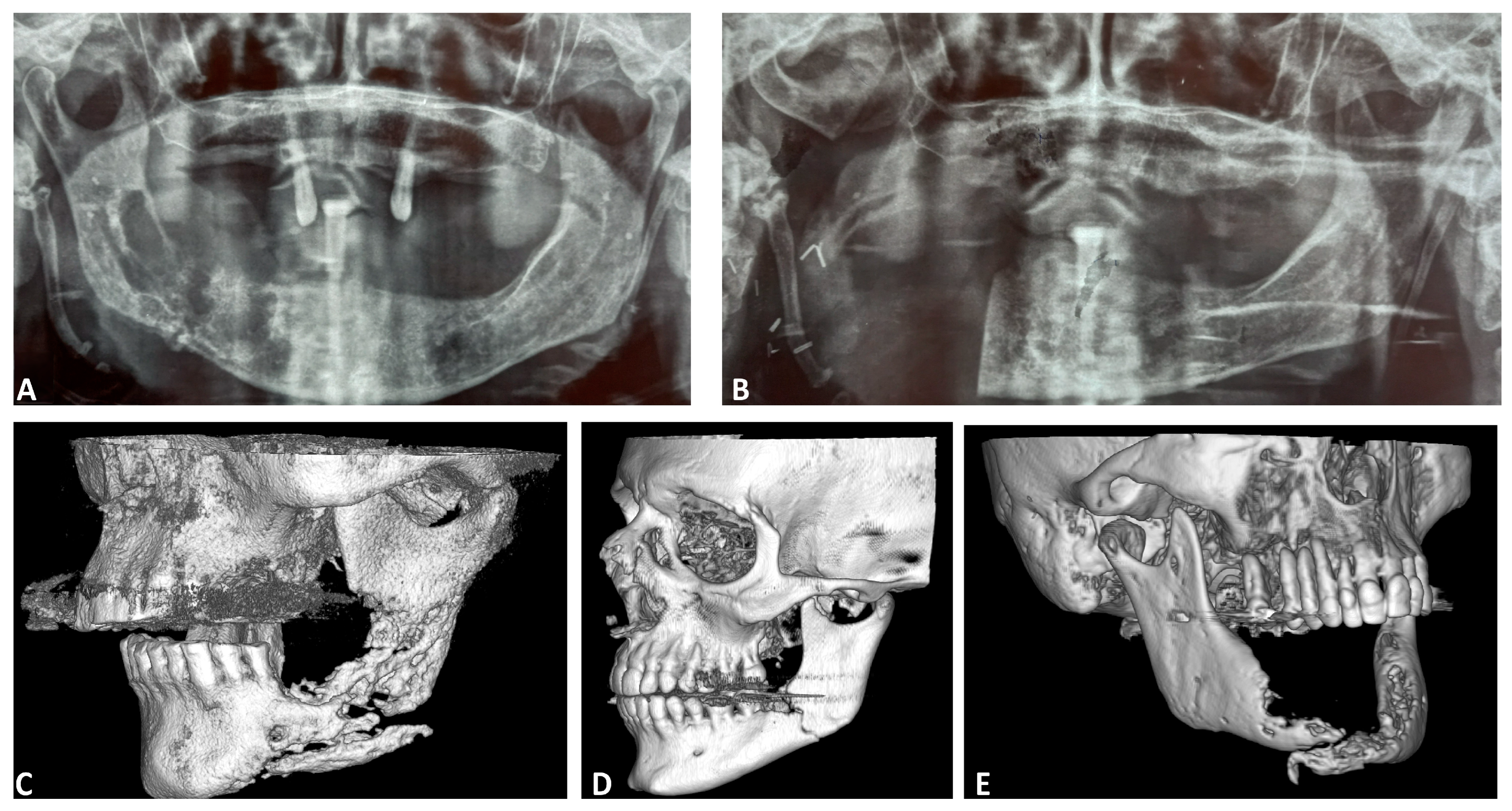 Diagnostics 15 01216 g001 Diagnostics 15 01216 g001