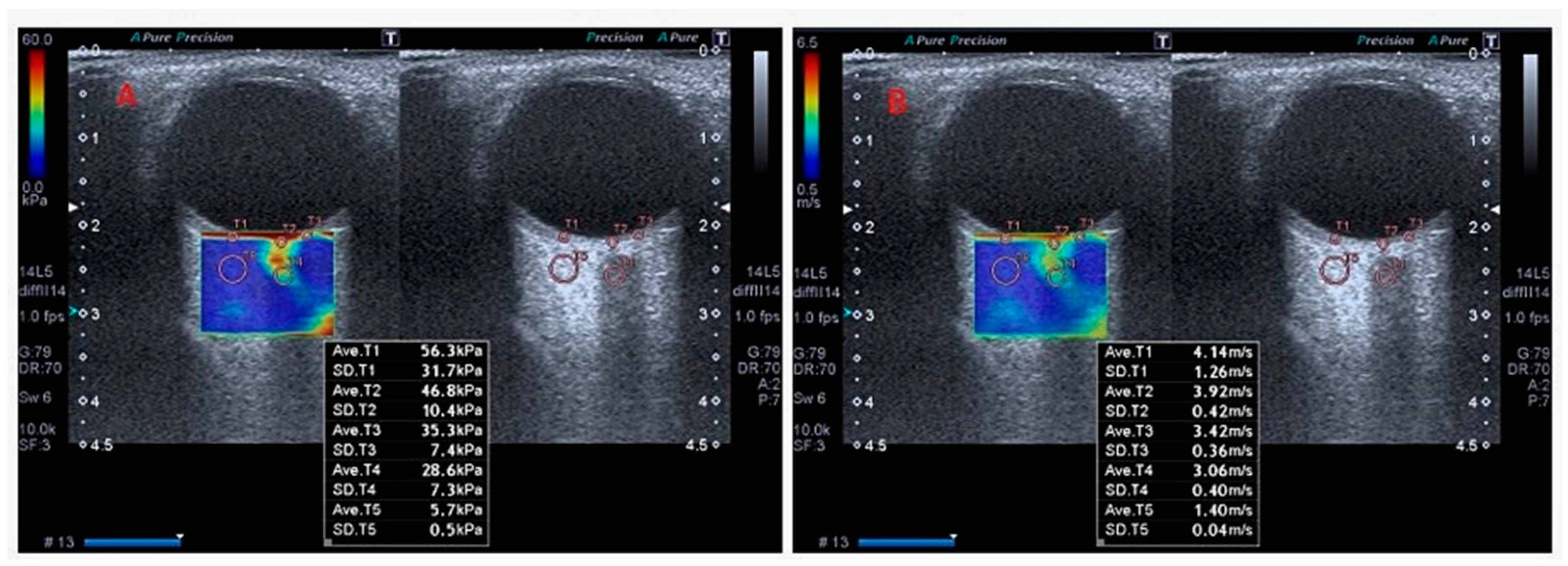Diagnostics 15 01227 g002