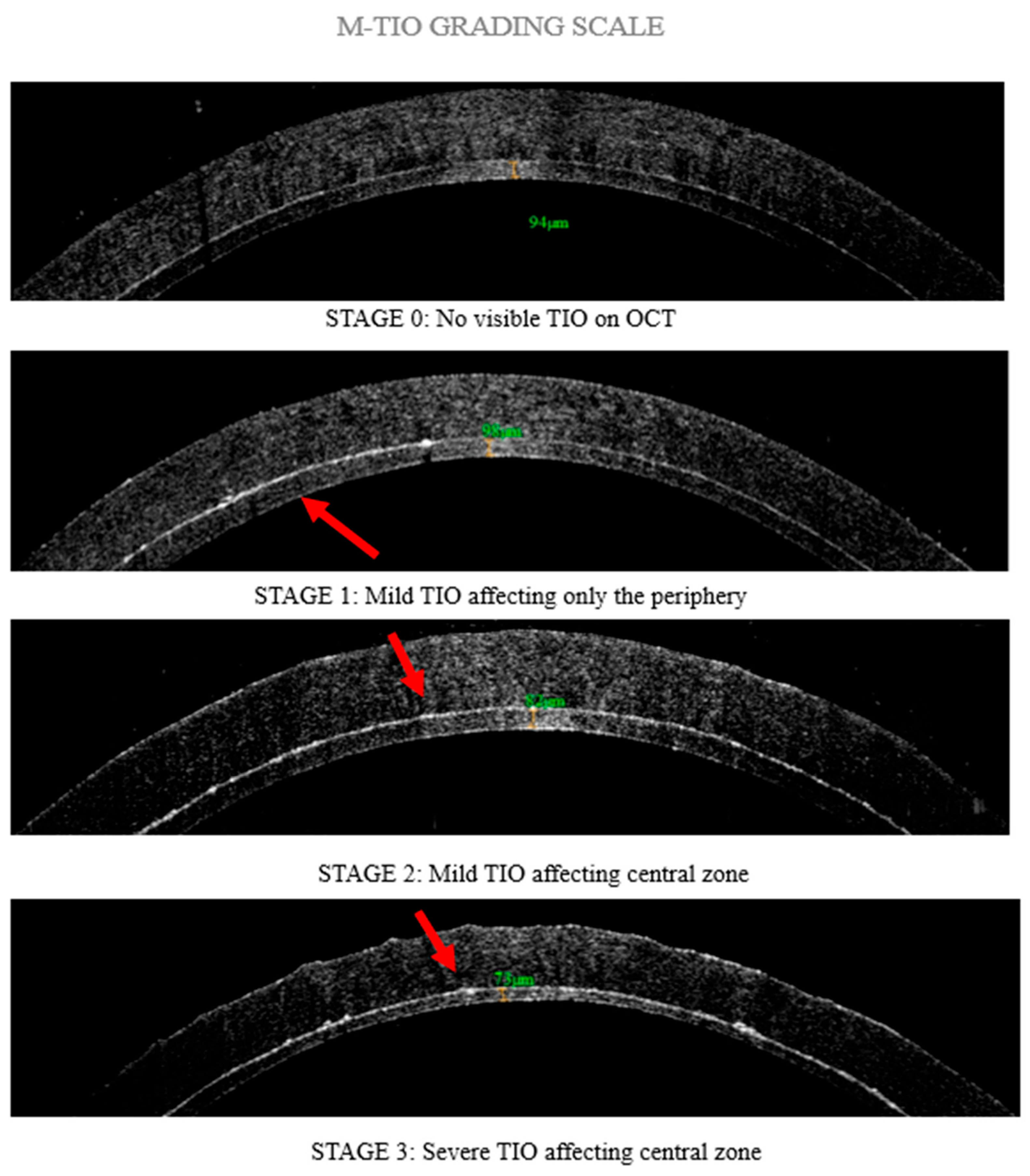 Diagnostics 15 01241 g002 Diagnostics 15 01241 g002