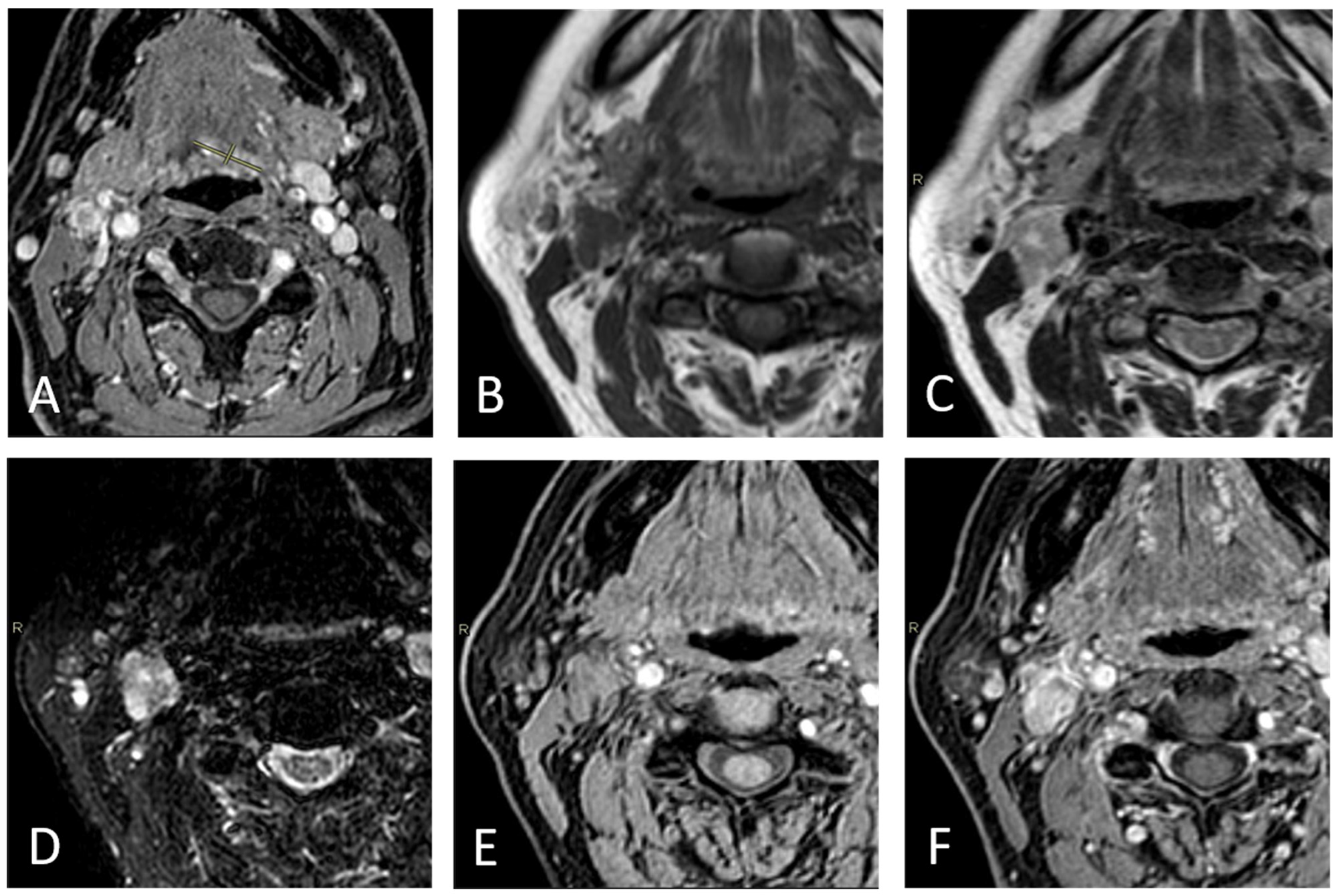 Diagnostics 15 01251 g003