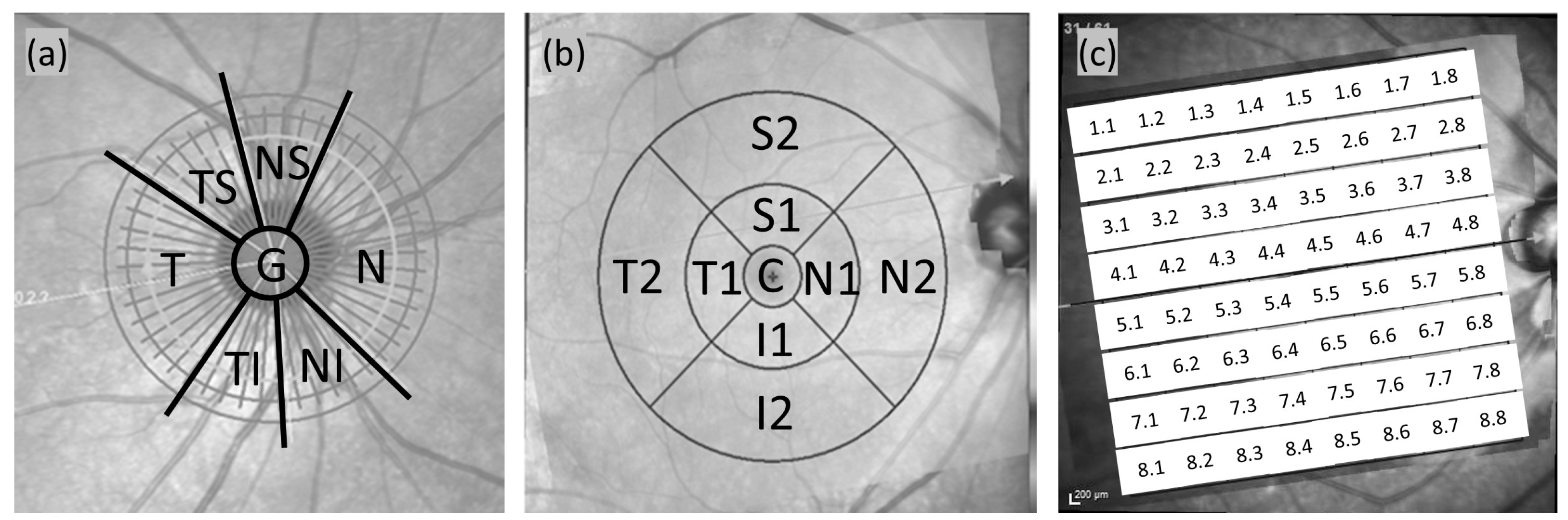 Diagnostics 15 01256 g001 Diagnostics 15 01256 g001