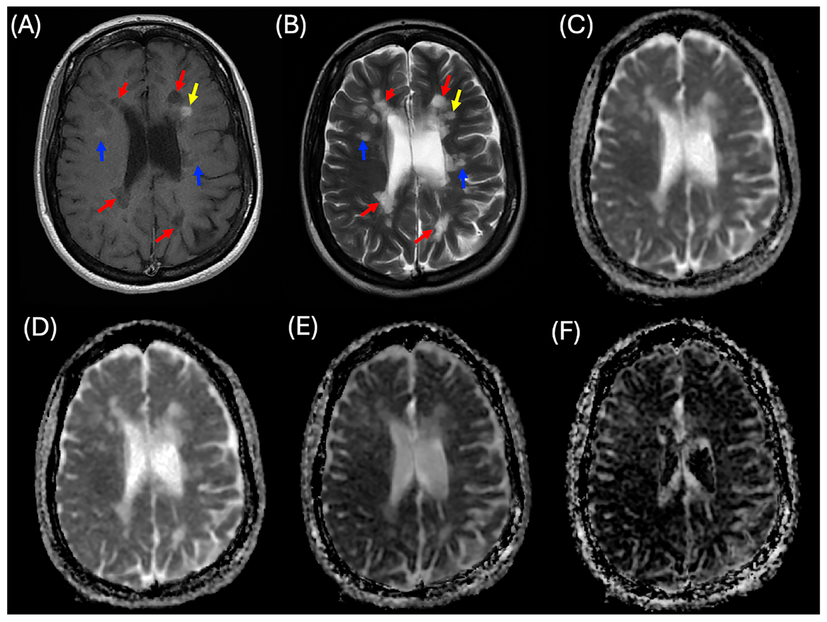 Diagnostics 15 01260 g001 Diagnostics 15 01260 g001