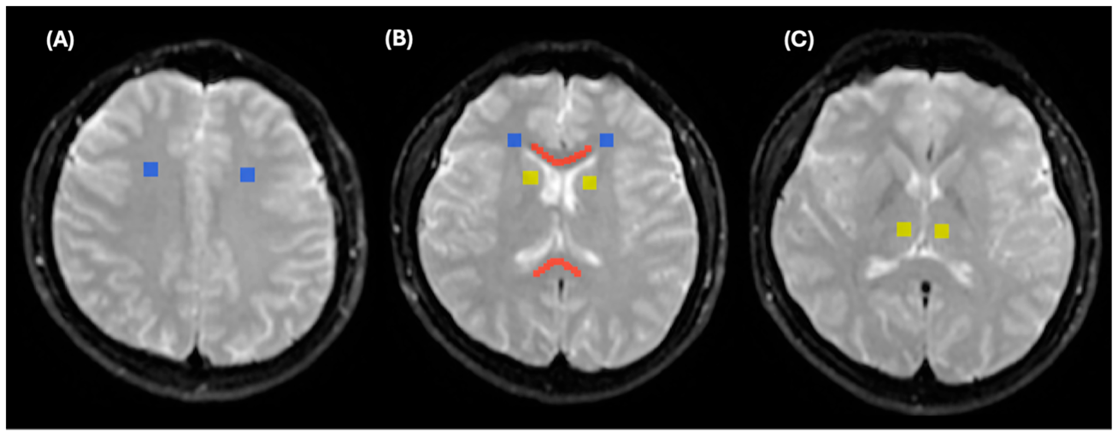 Diagnostics 15 01260 g005 Diagnostics 15 01260 g005