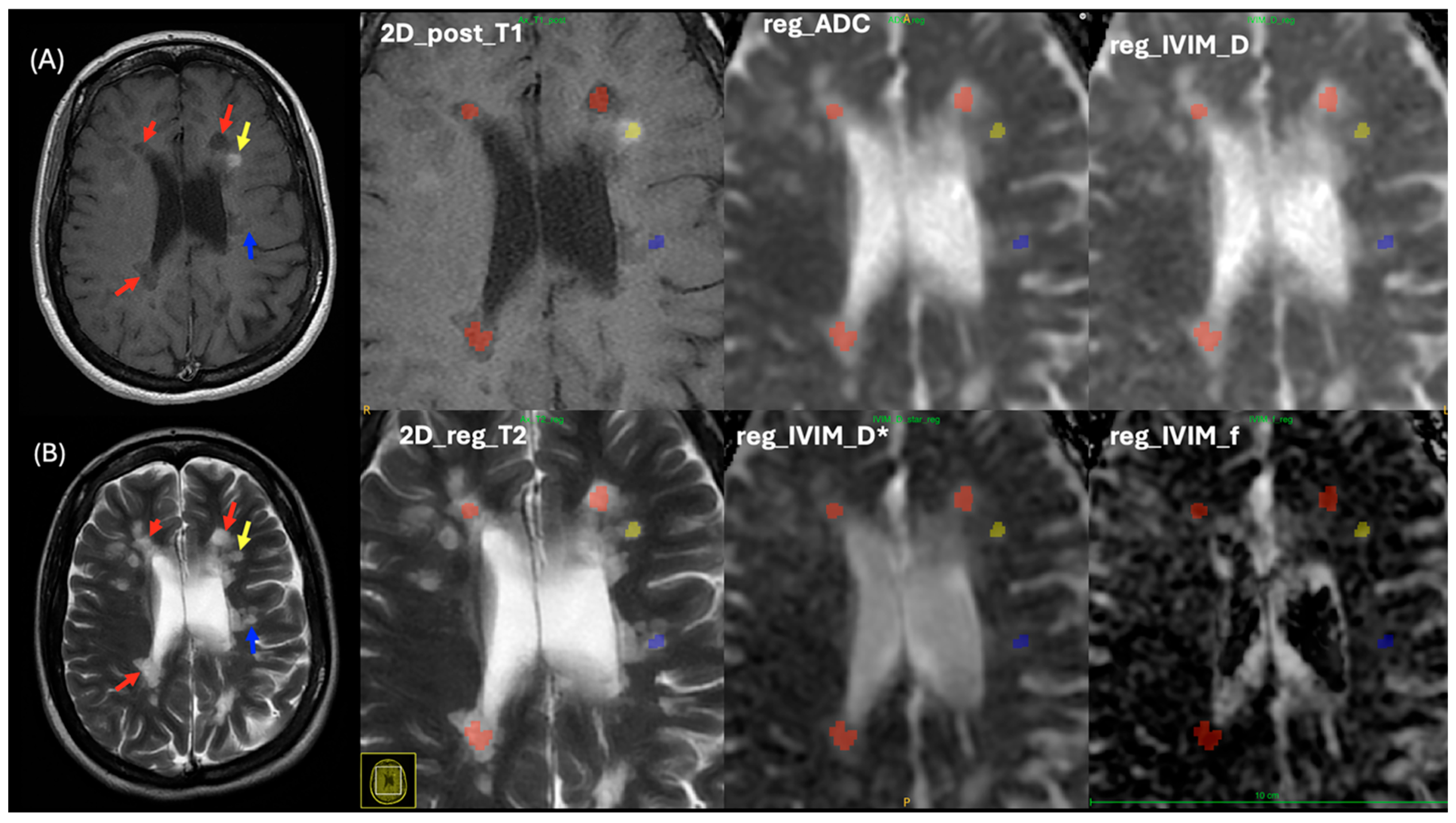 Diagnostics 15 01260 g006 Diagnostics 15 01260 g006