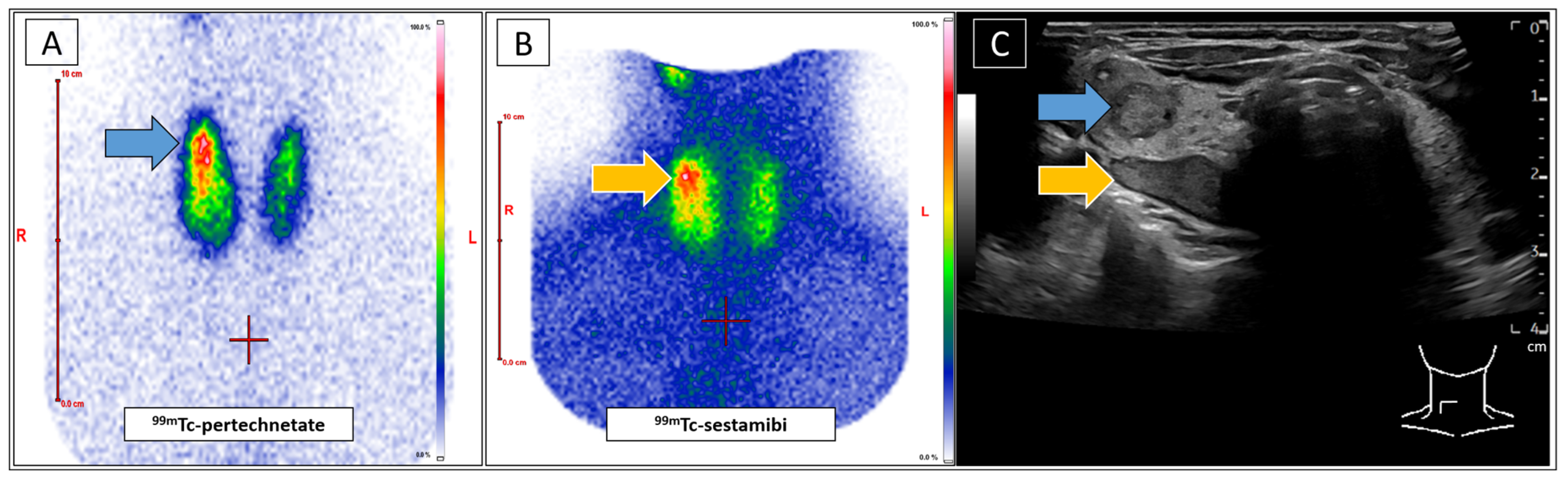 Diagnostics 15 01262 g001