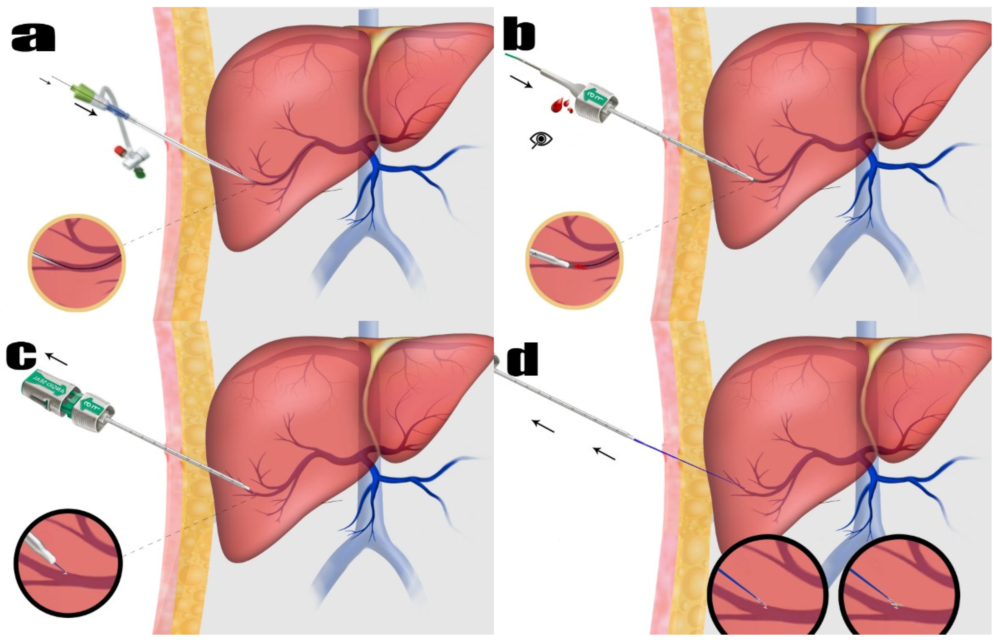 Diagnostics 15 01266 g001