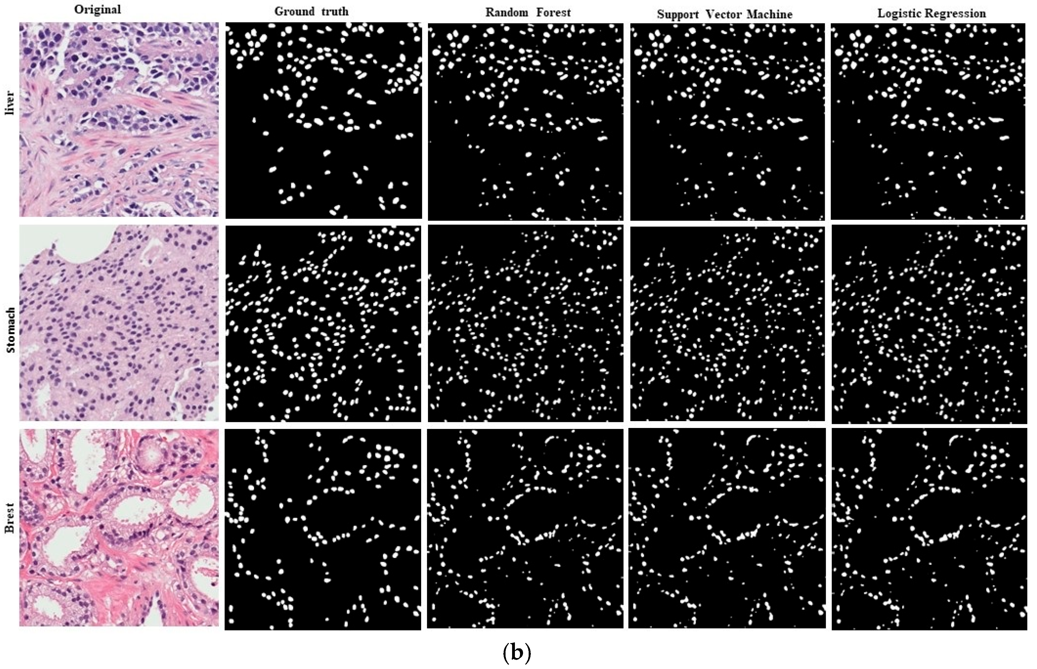 Diagnostics 15 01271 g011b Diagnostics 15 01271 g011b