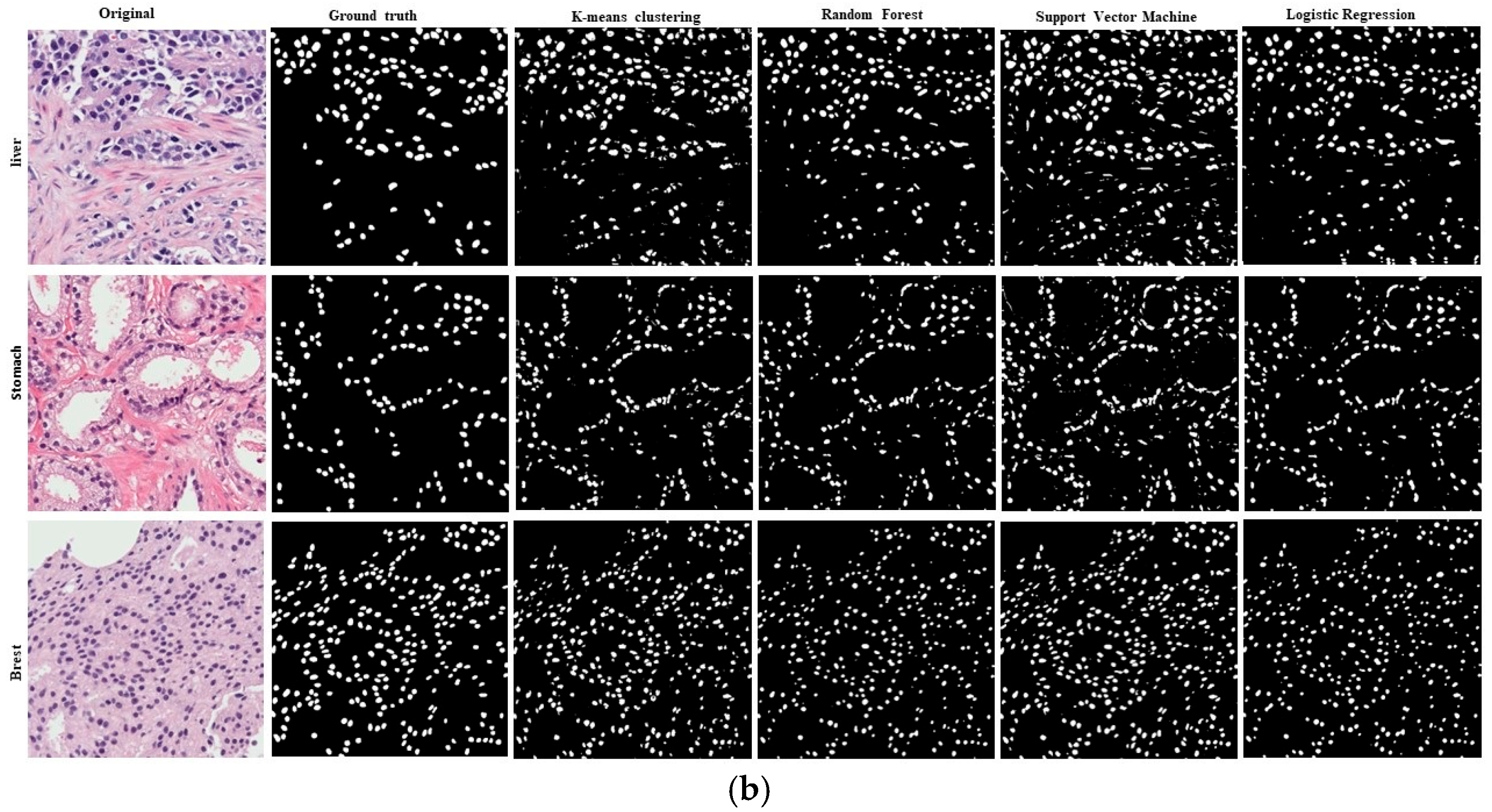 Diagnostics 15 01271 g012b Diagnostics 15 01271 g012b