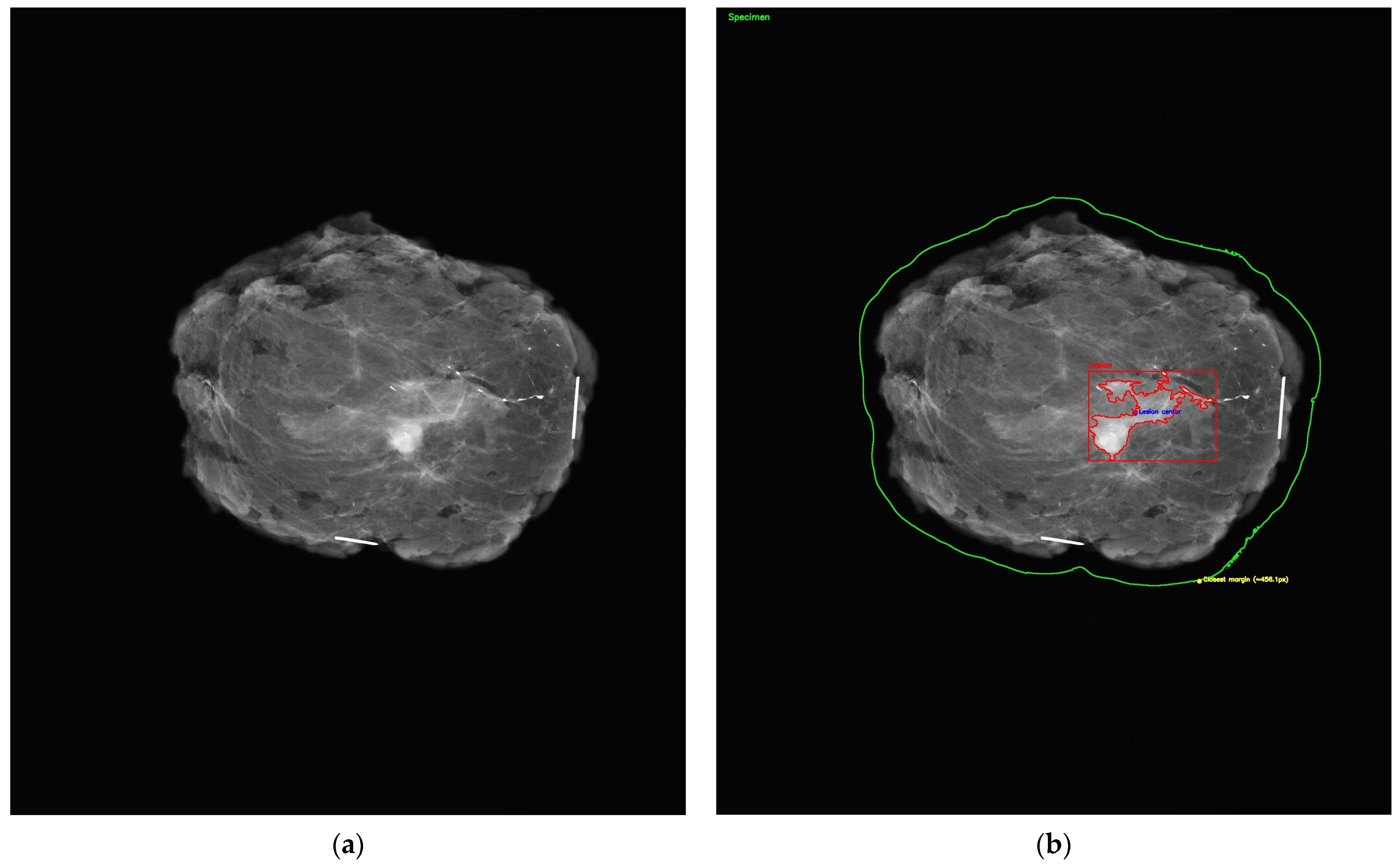 Diagnostics 15 01276 g002