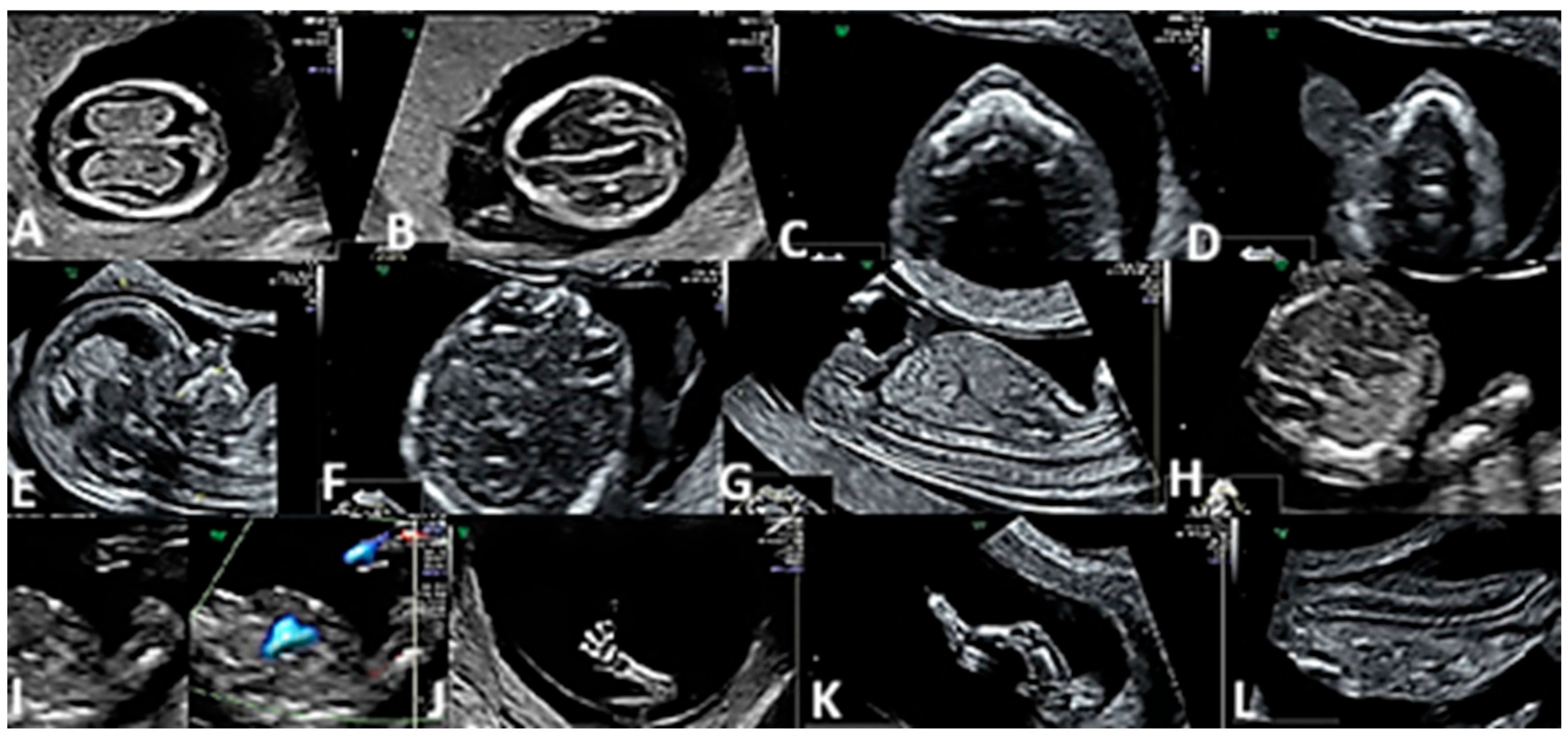 Diagnostics 15 01277 g001