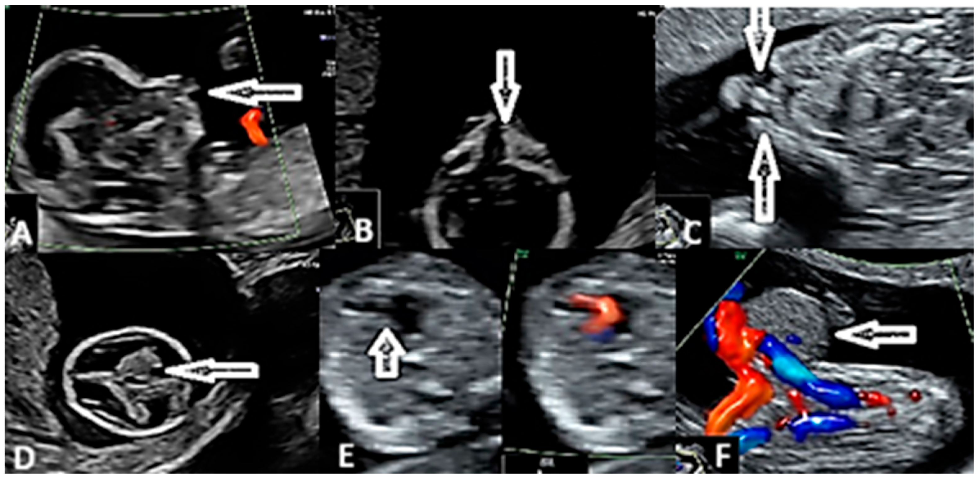 Diagnostics 15 01277 g003