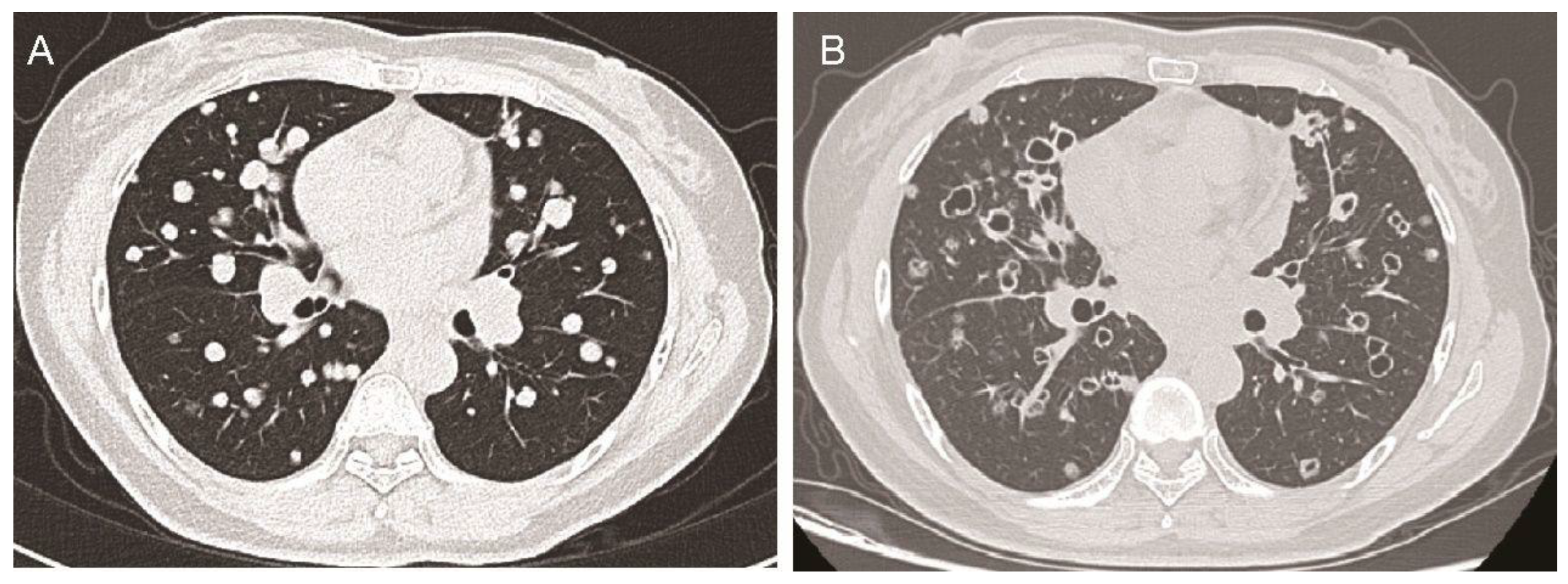 Diagnostics 15 01280 g001
