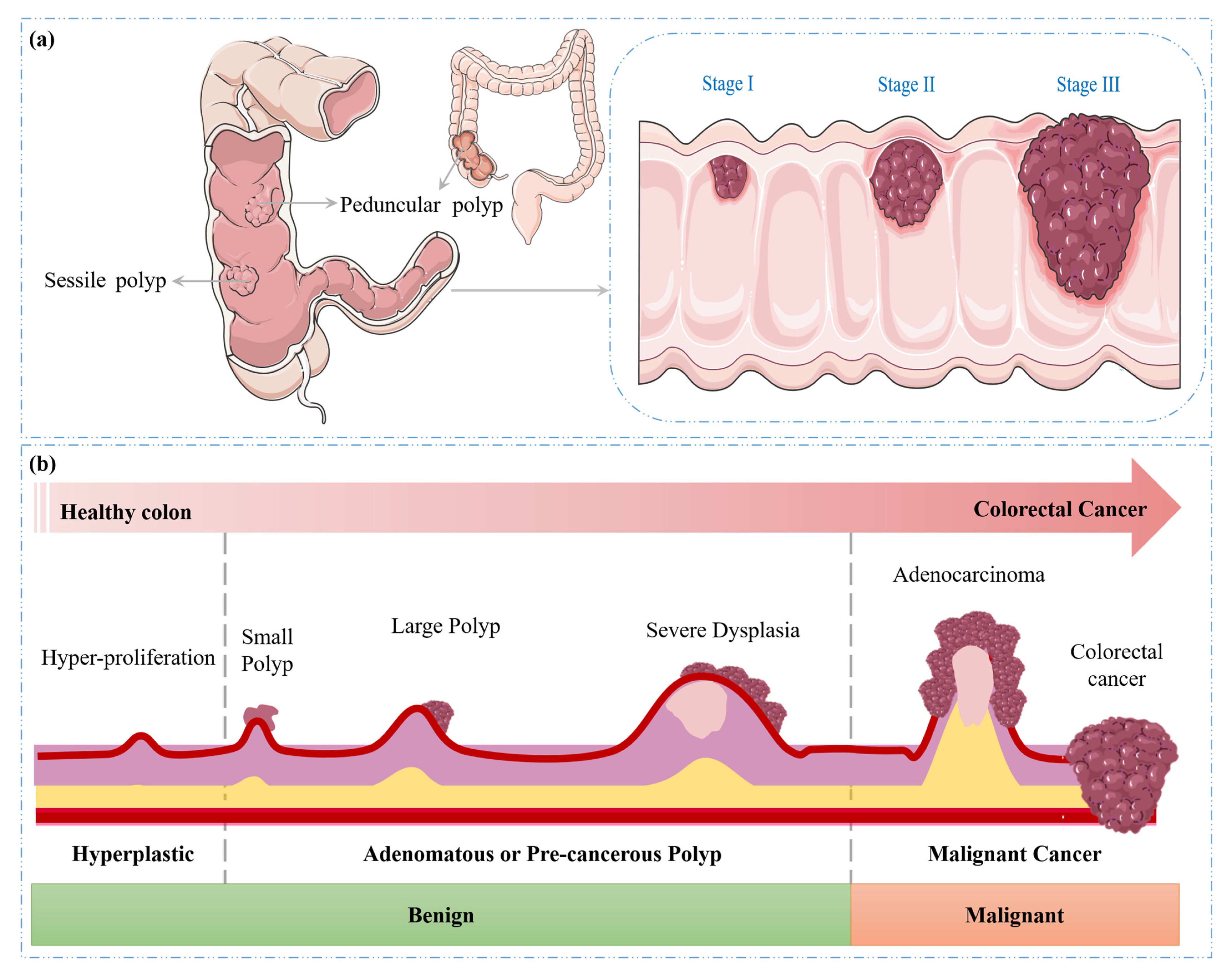 Diagnostics 15 01285 g003