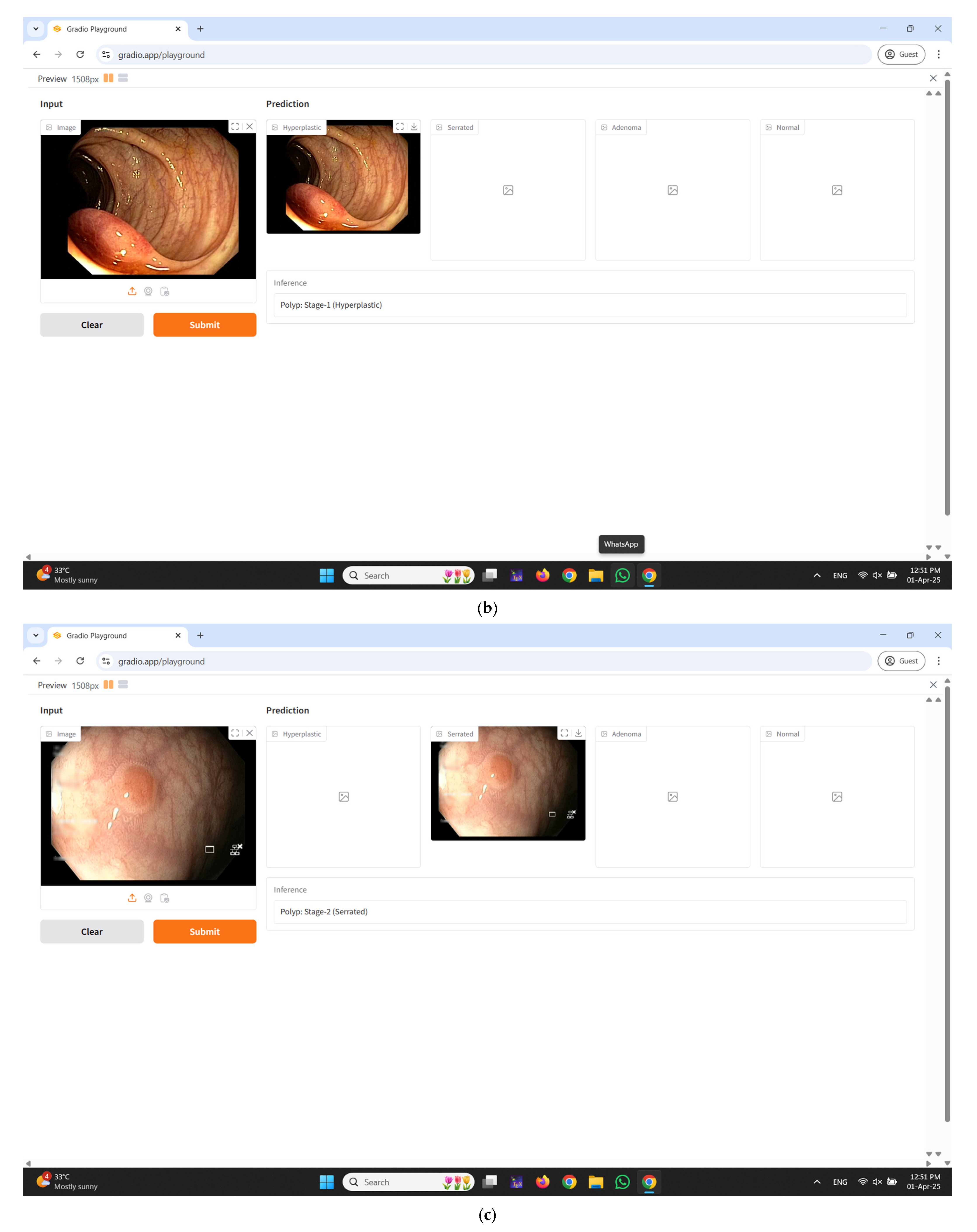 Diagnostics 15 01285 g011b
