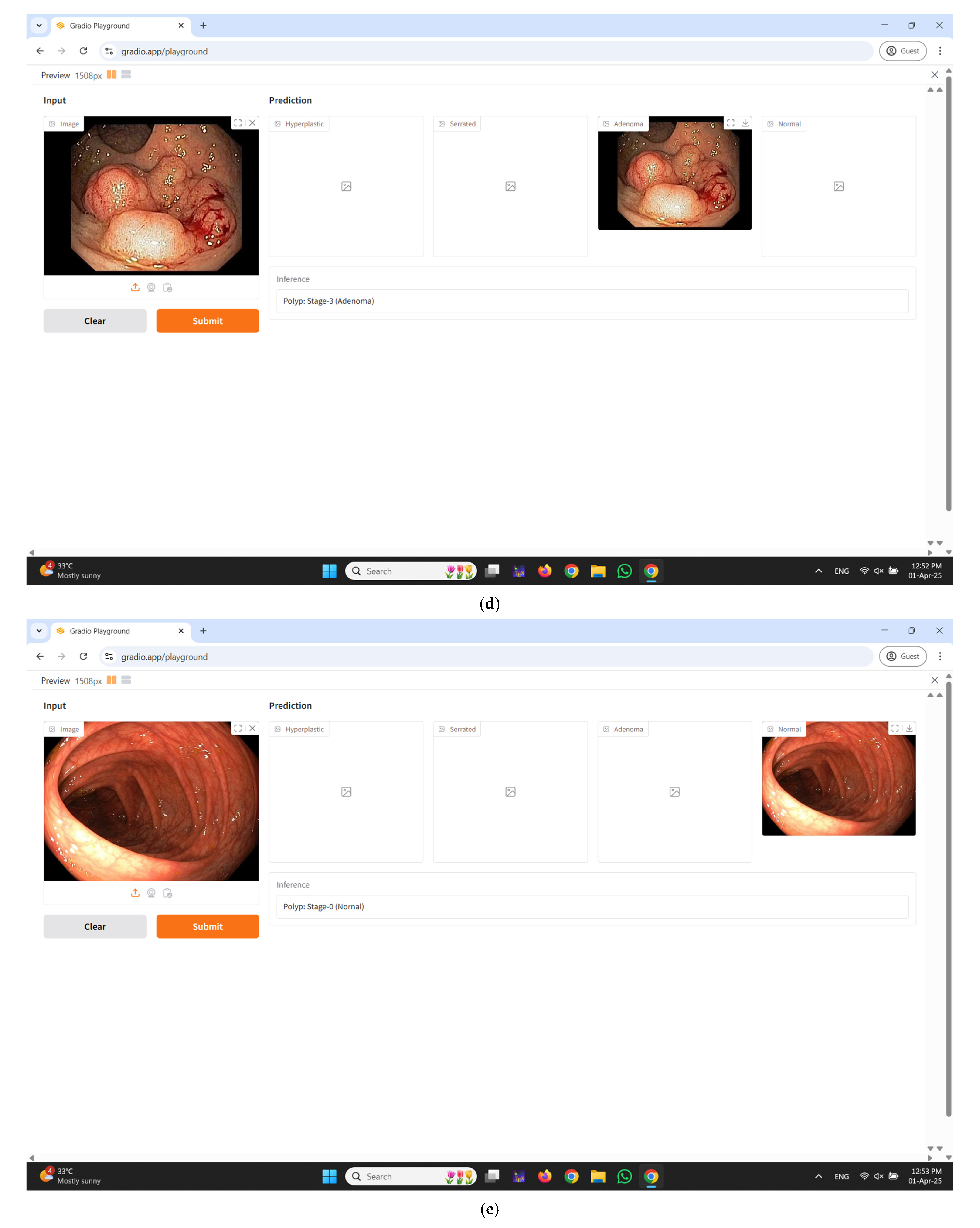 Diagnostics 15 01285 g011c