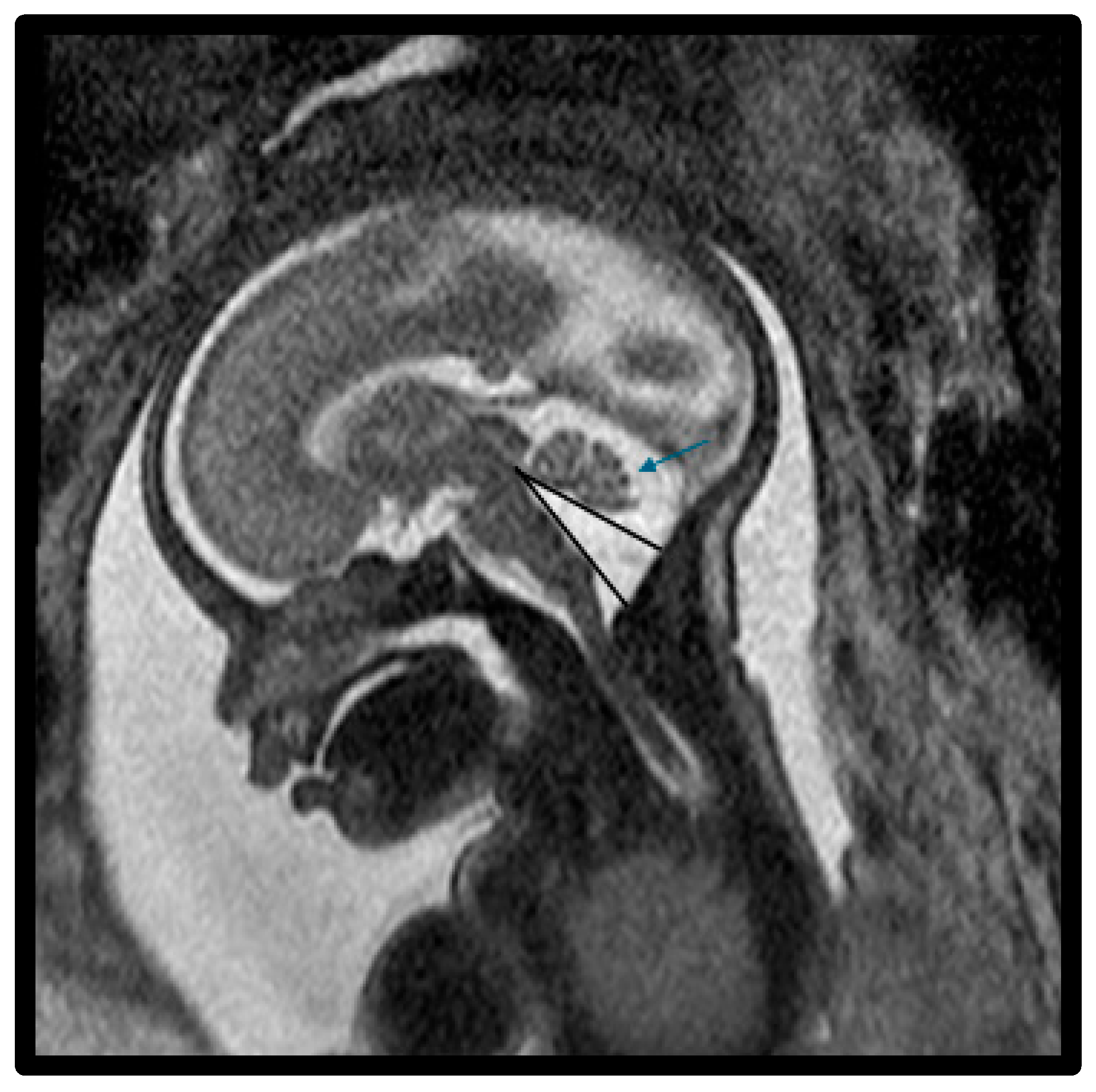 Diagnostics 15 01295 g002