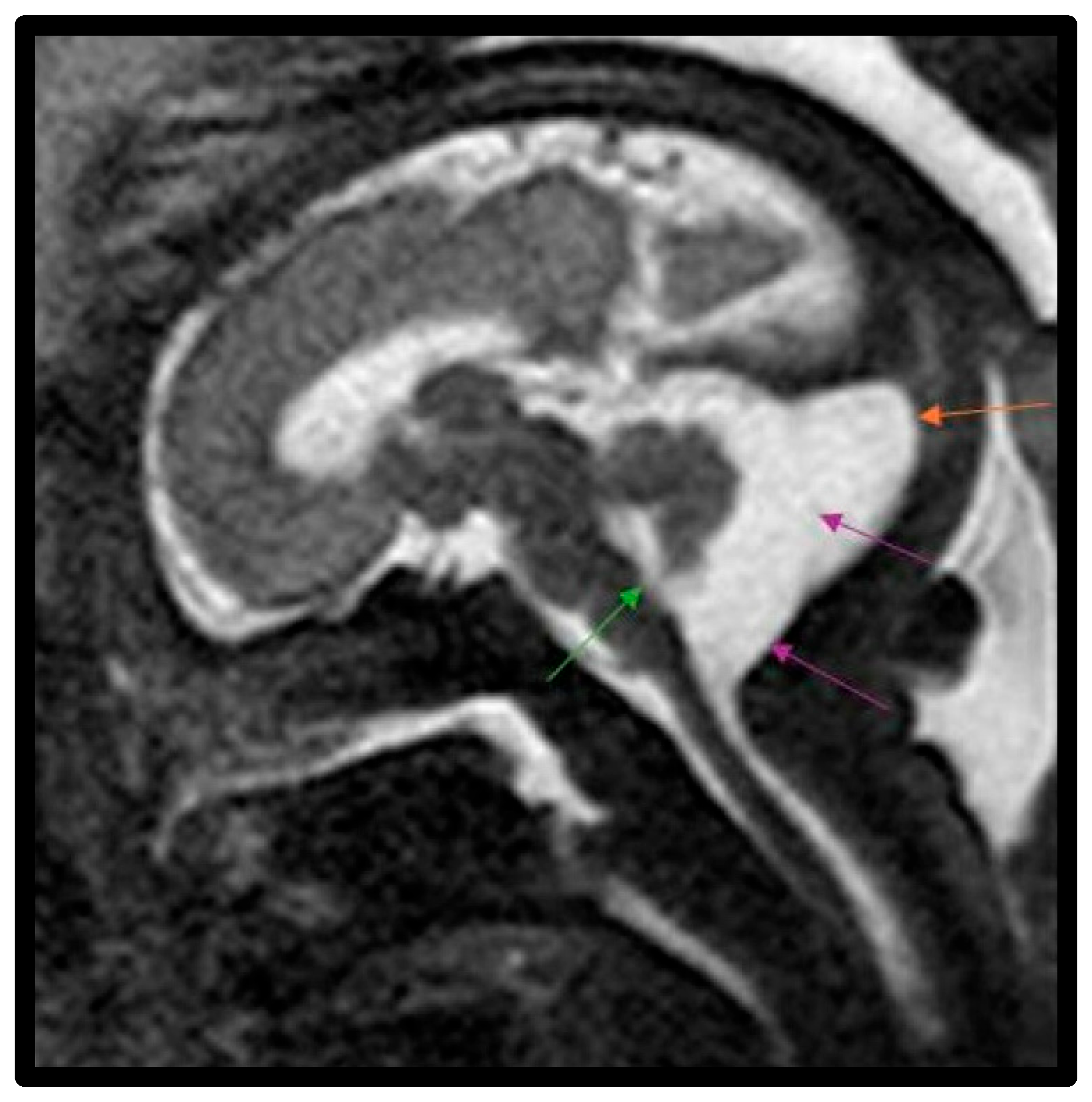 Diagnostics 15 01295 g003