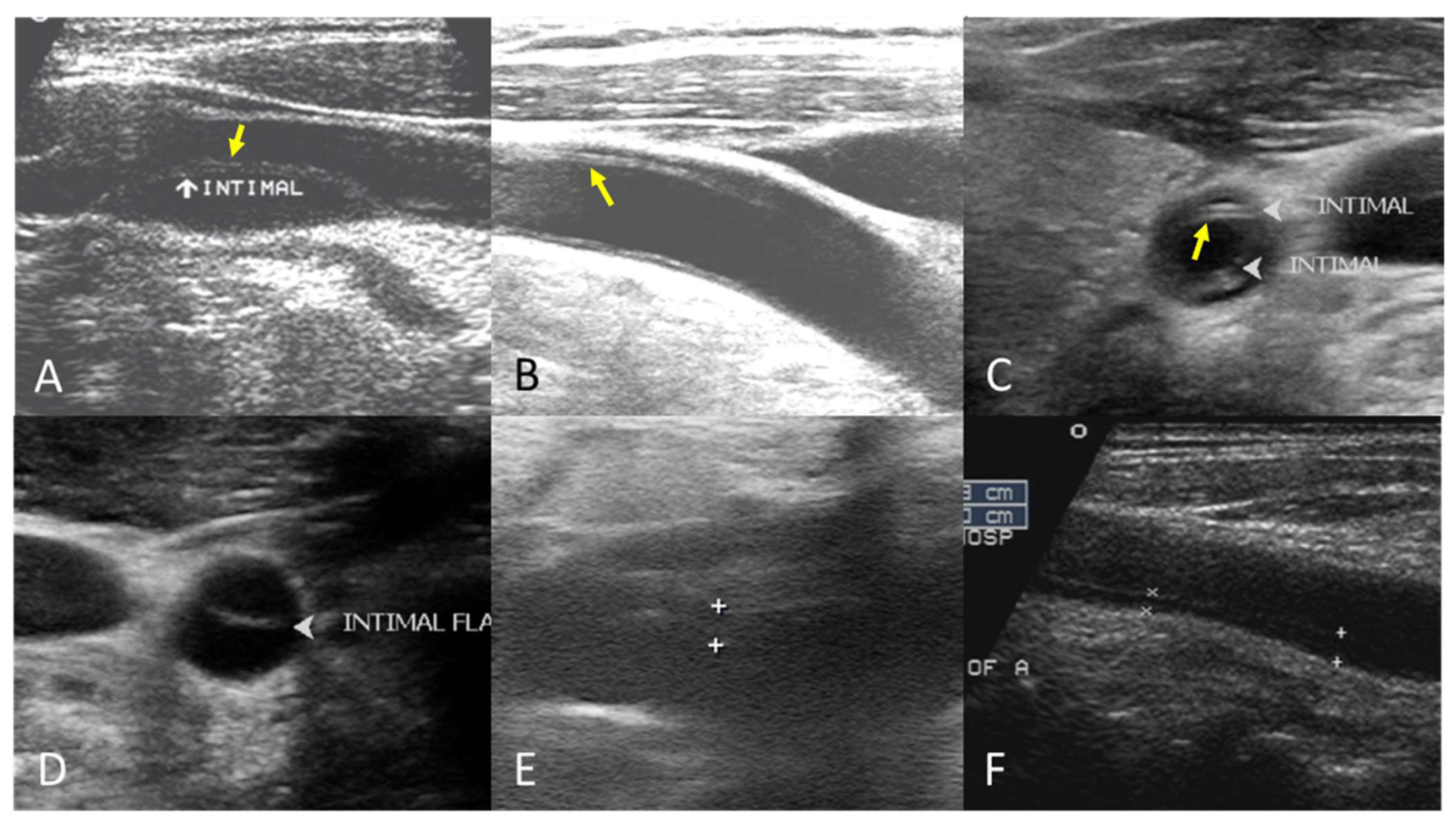 Diagnostics 15 01297 g002