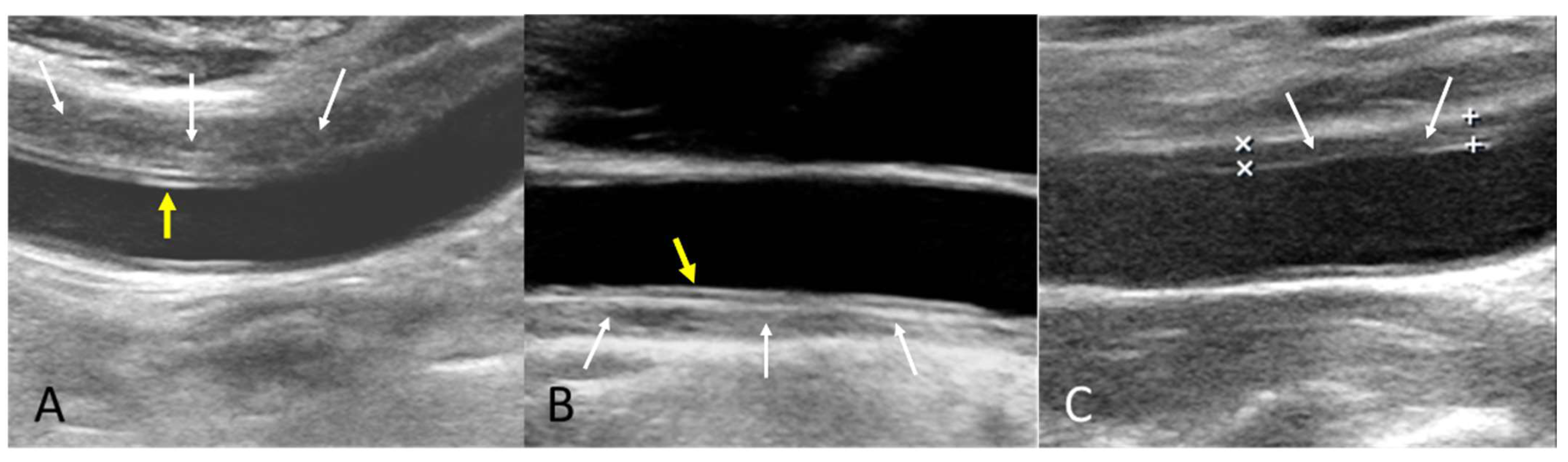 Diagnostics 15 01297 g003