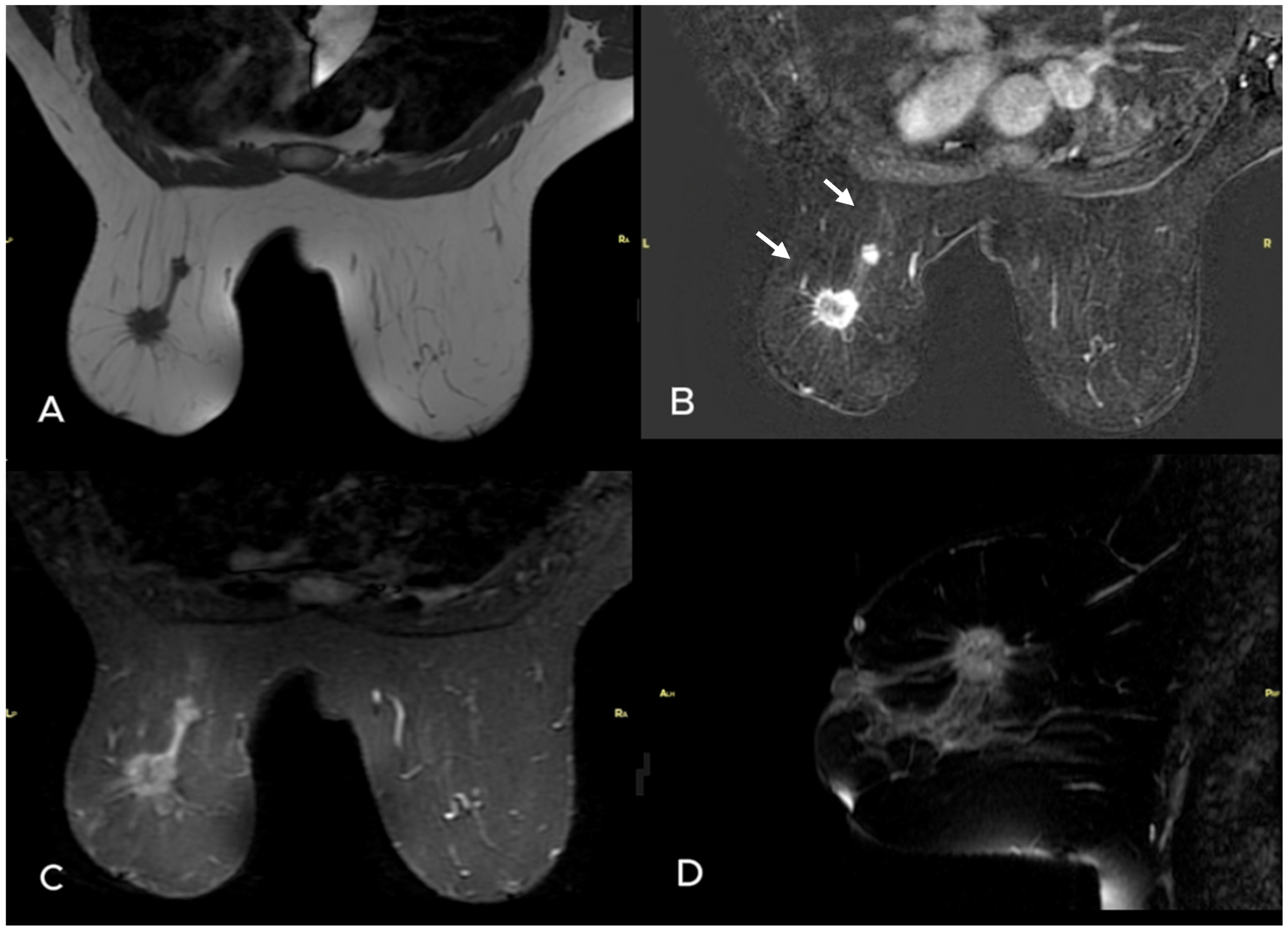 Diagnostics 15 01300 g001