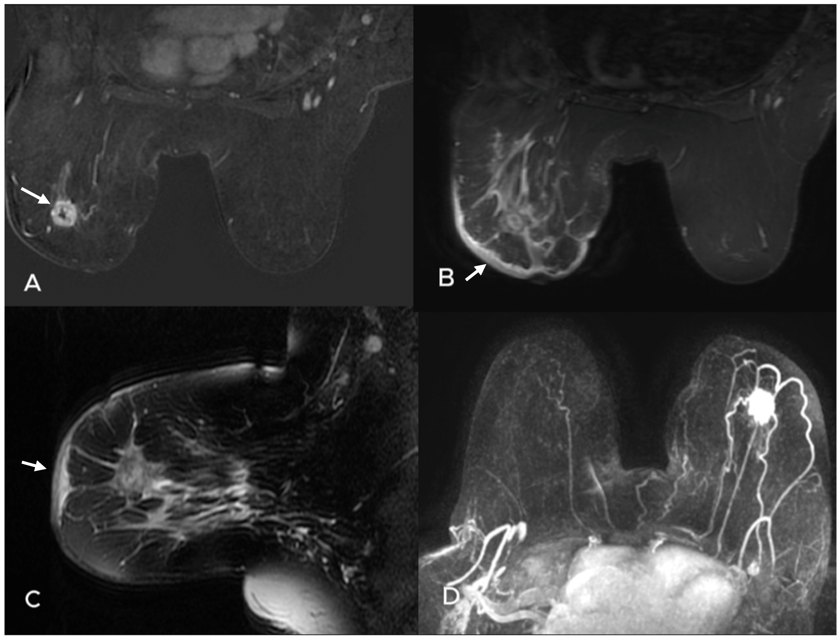Diagnostics 15 01300 g002
