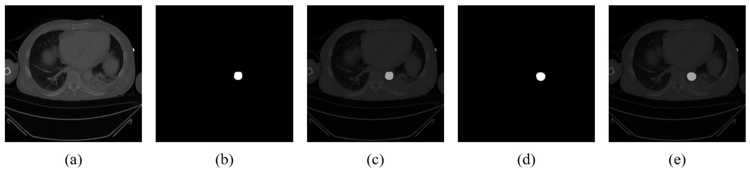 Diagnostics 15 01312 g003 Diagnostics 15 01312 g003