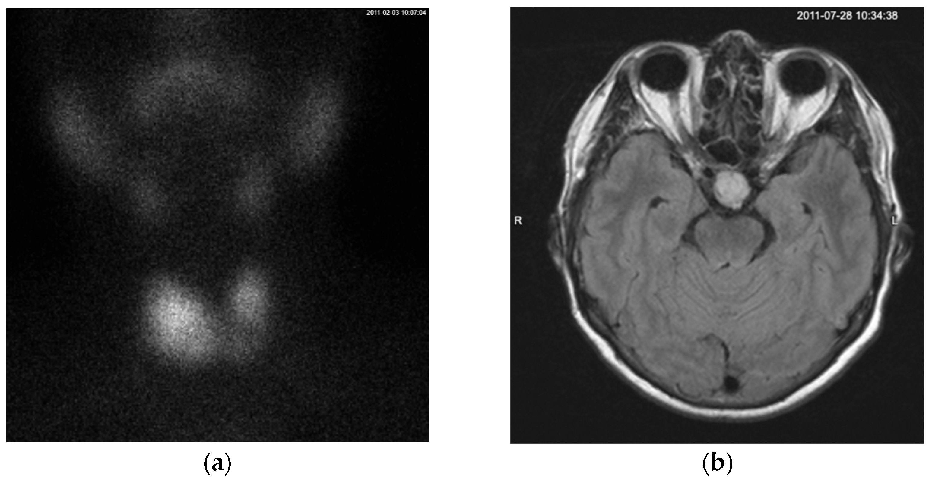 Diagnostics 15 01313 g001 Diagnostics 15 01313 g001