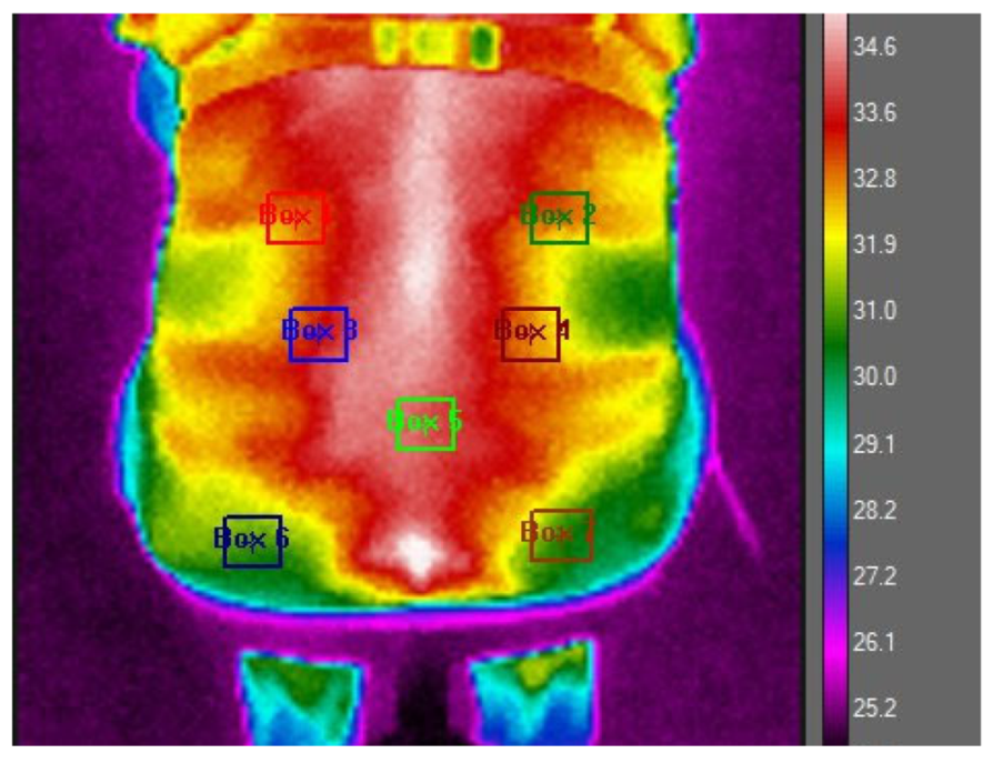 Diagnostics 15 01317 g001