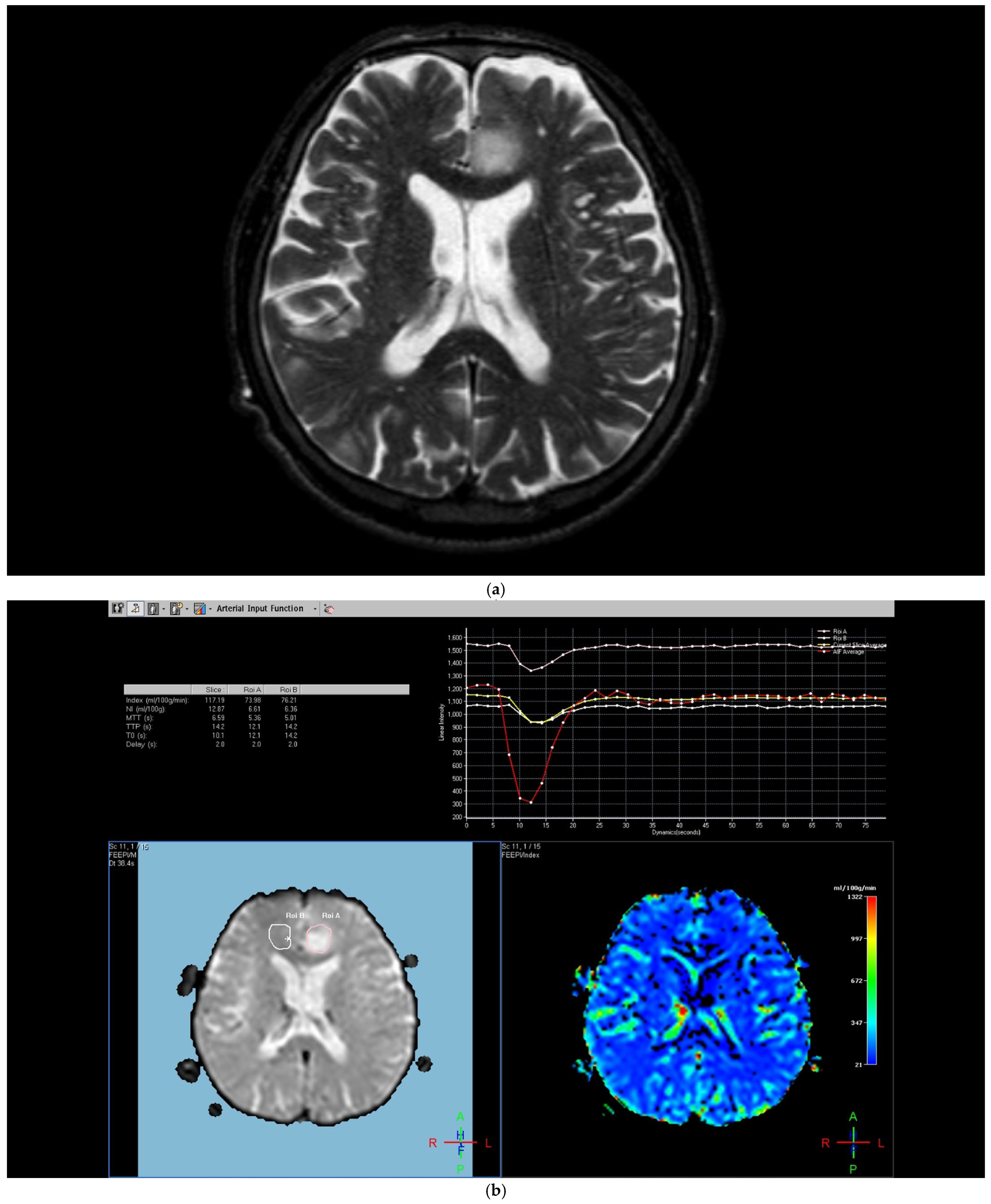 Diagnostics 15 01324 g001a