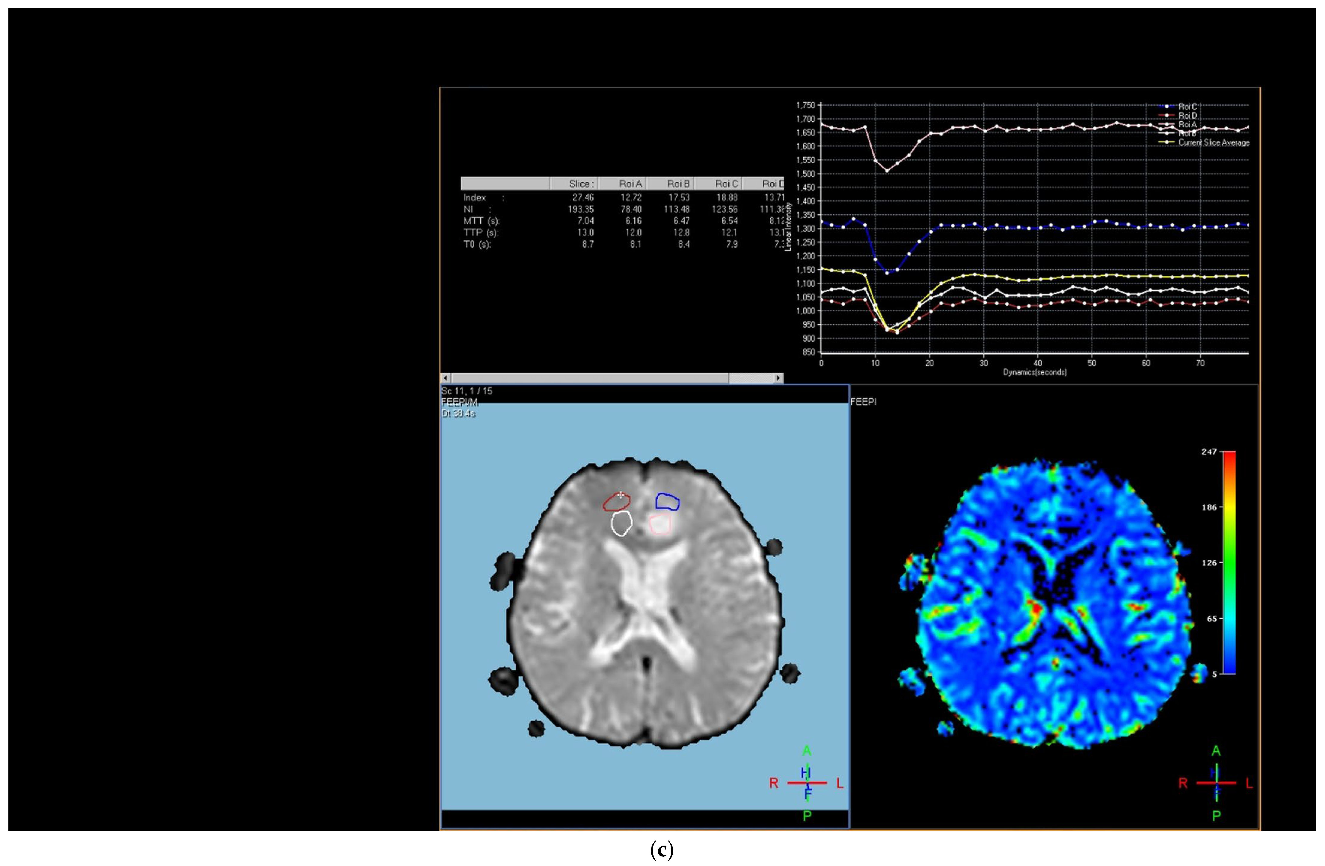 Diagnostics 15 01324 g001b