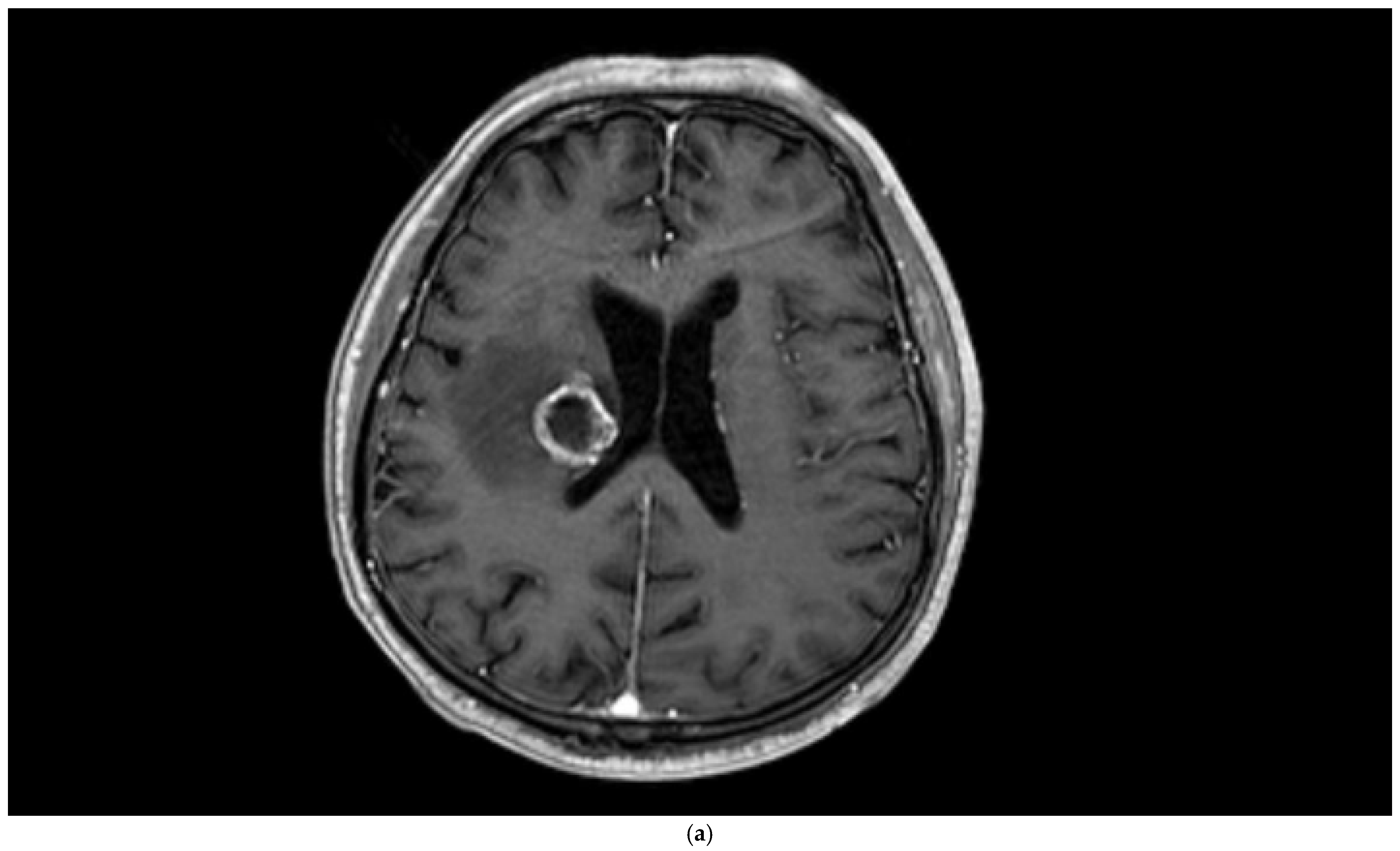 Diagnostics 15 01324 g002a