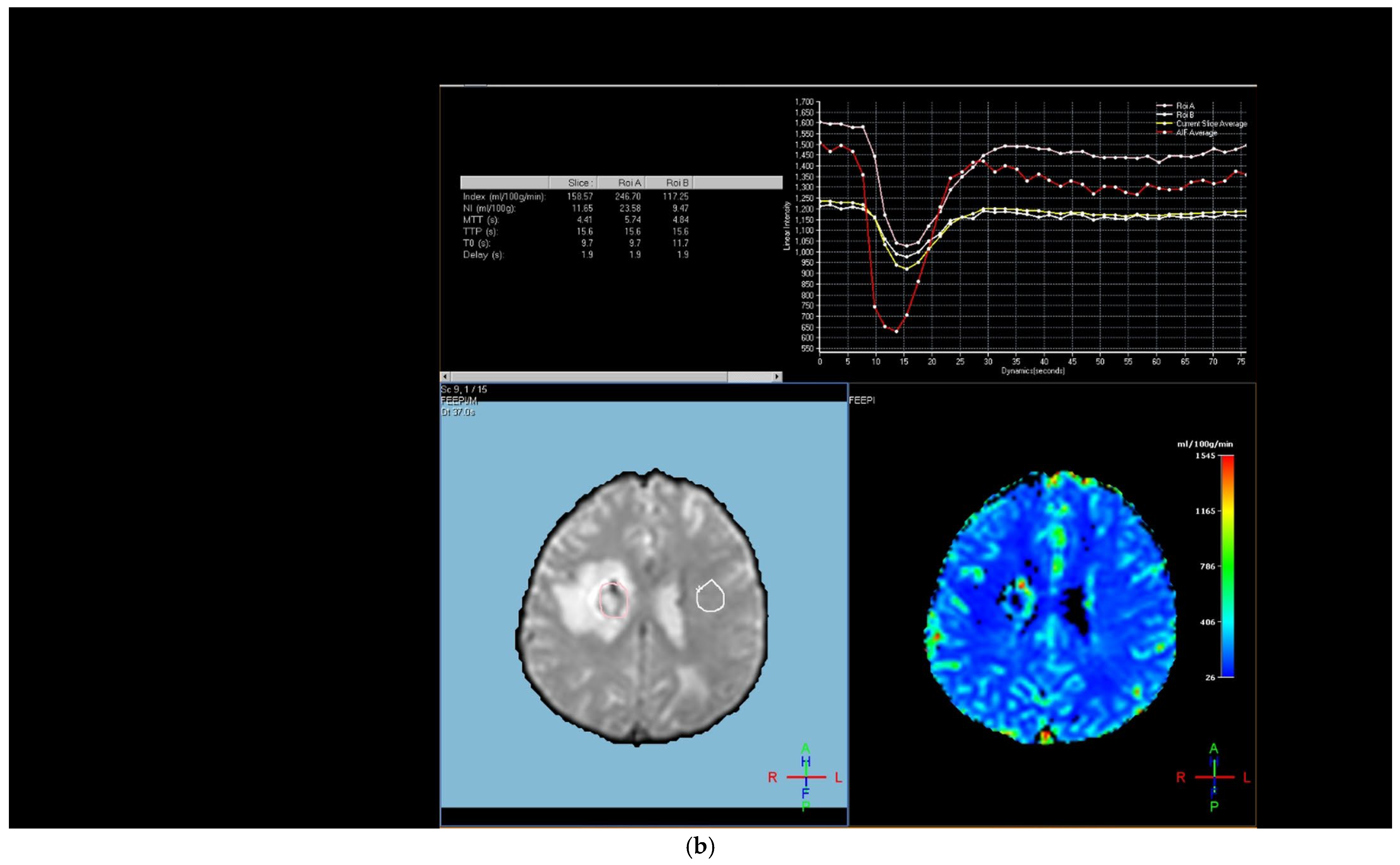 Diagnostics 15 01324 g002b