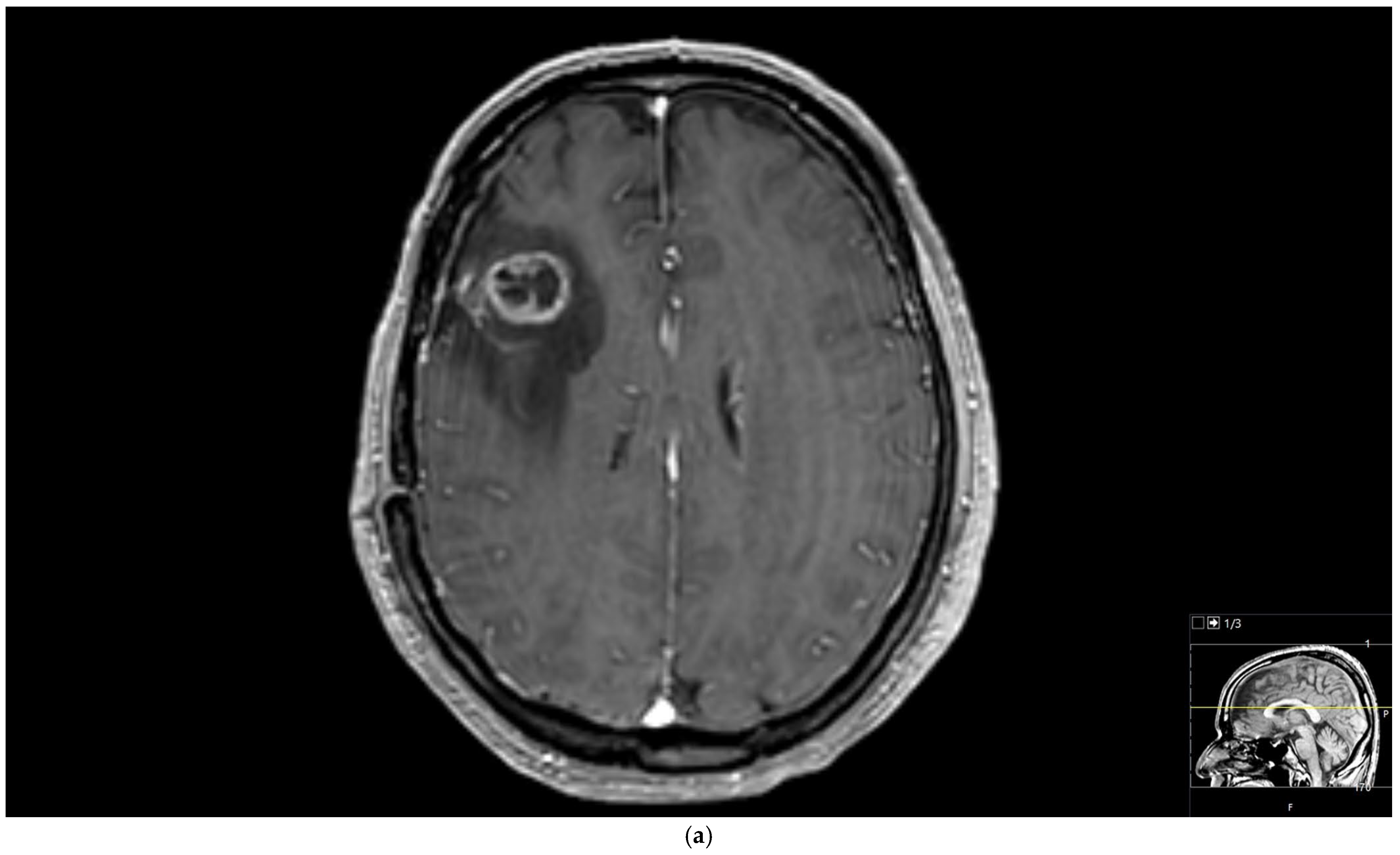 Diagnostics 15 01324 g003a